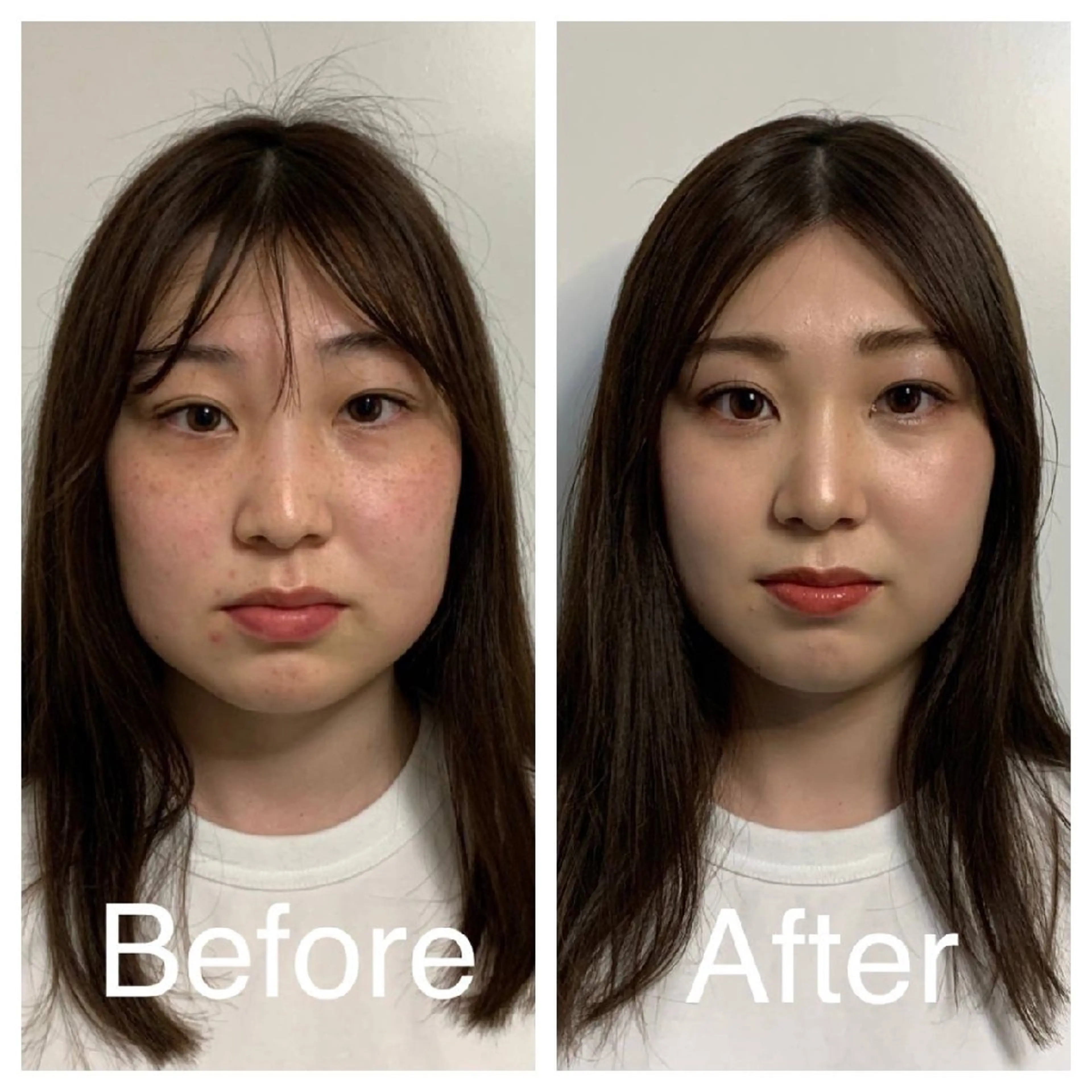 医療提携サロン新宿 La Lunaのエステ・リラクイメージ