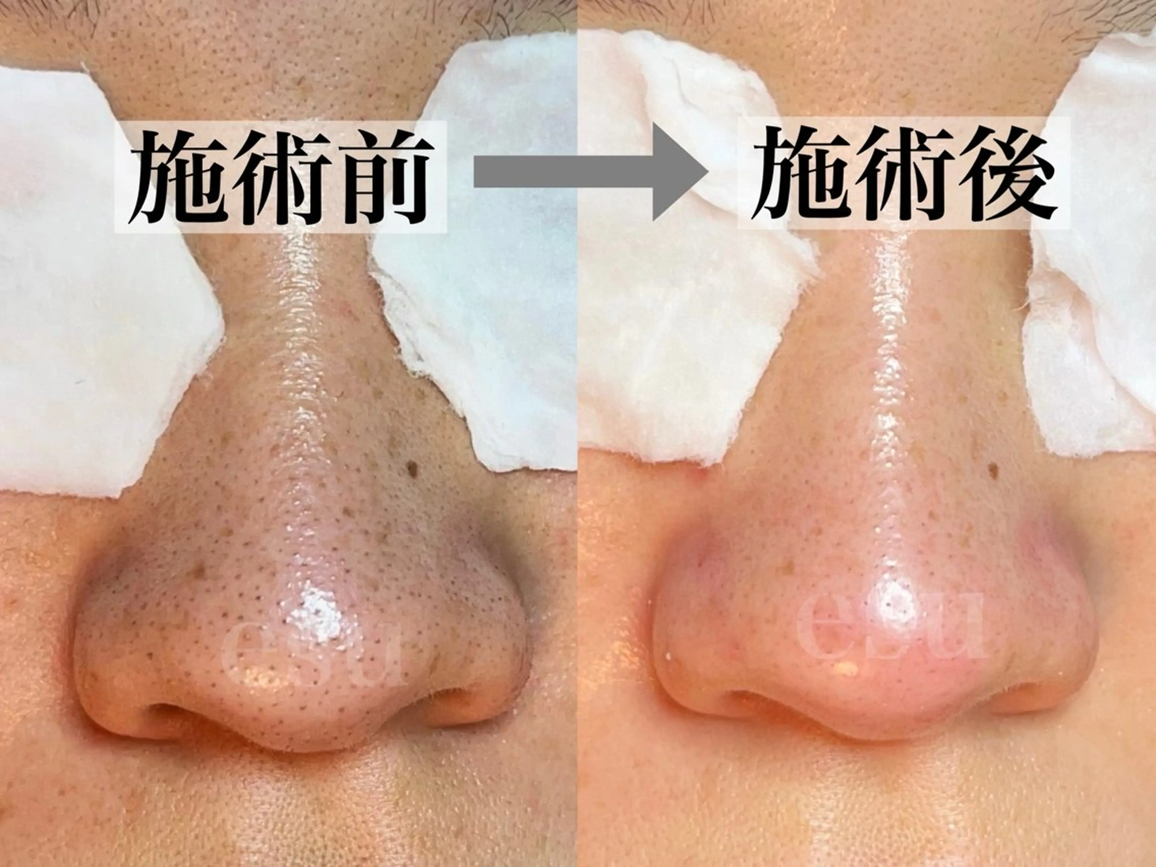 毛穴ケア専門店 esu(エス)のエステ・リラクイメージ