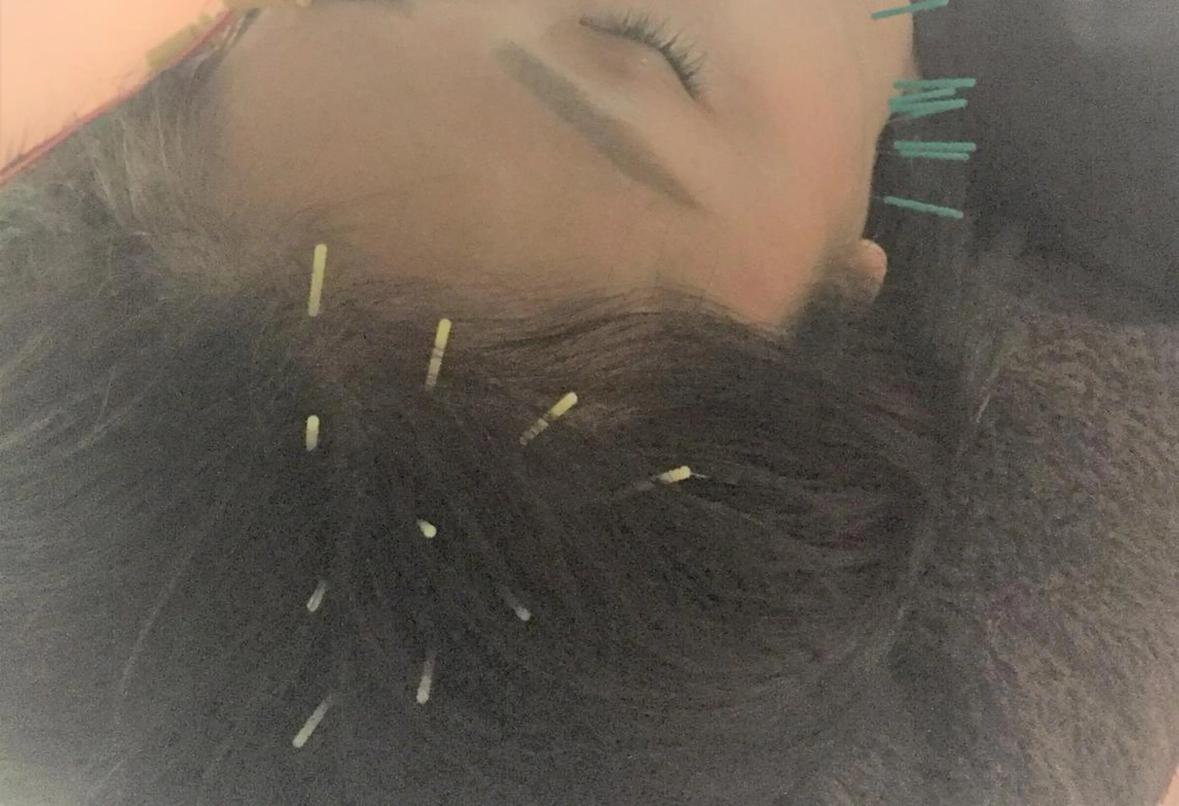 小顔矯正&美容鍼 東洋健美のエステ・リラクイメージ