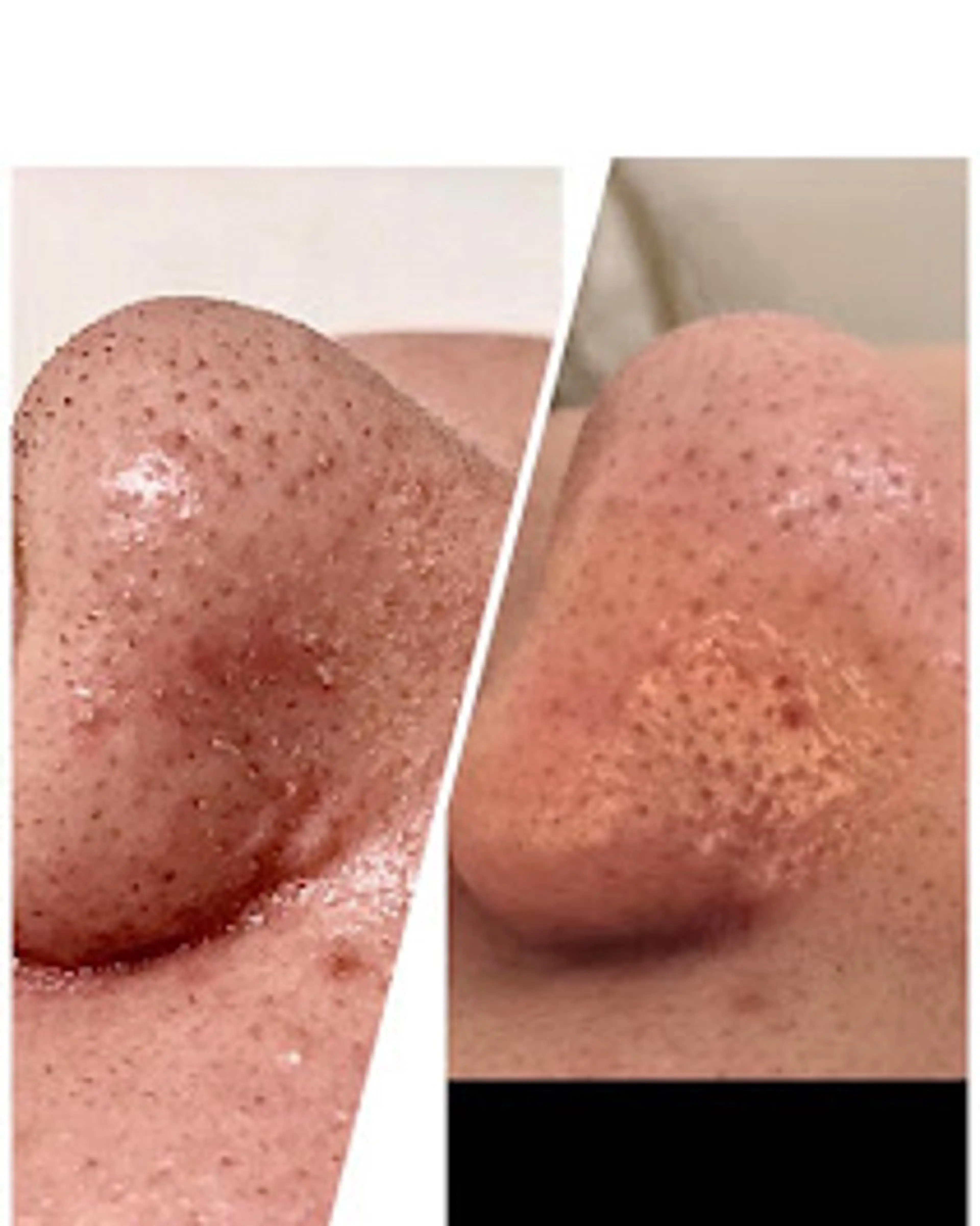 エステ ビューティーサロン ソナタのエステ・リラクイメージ