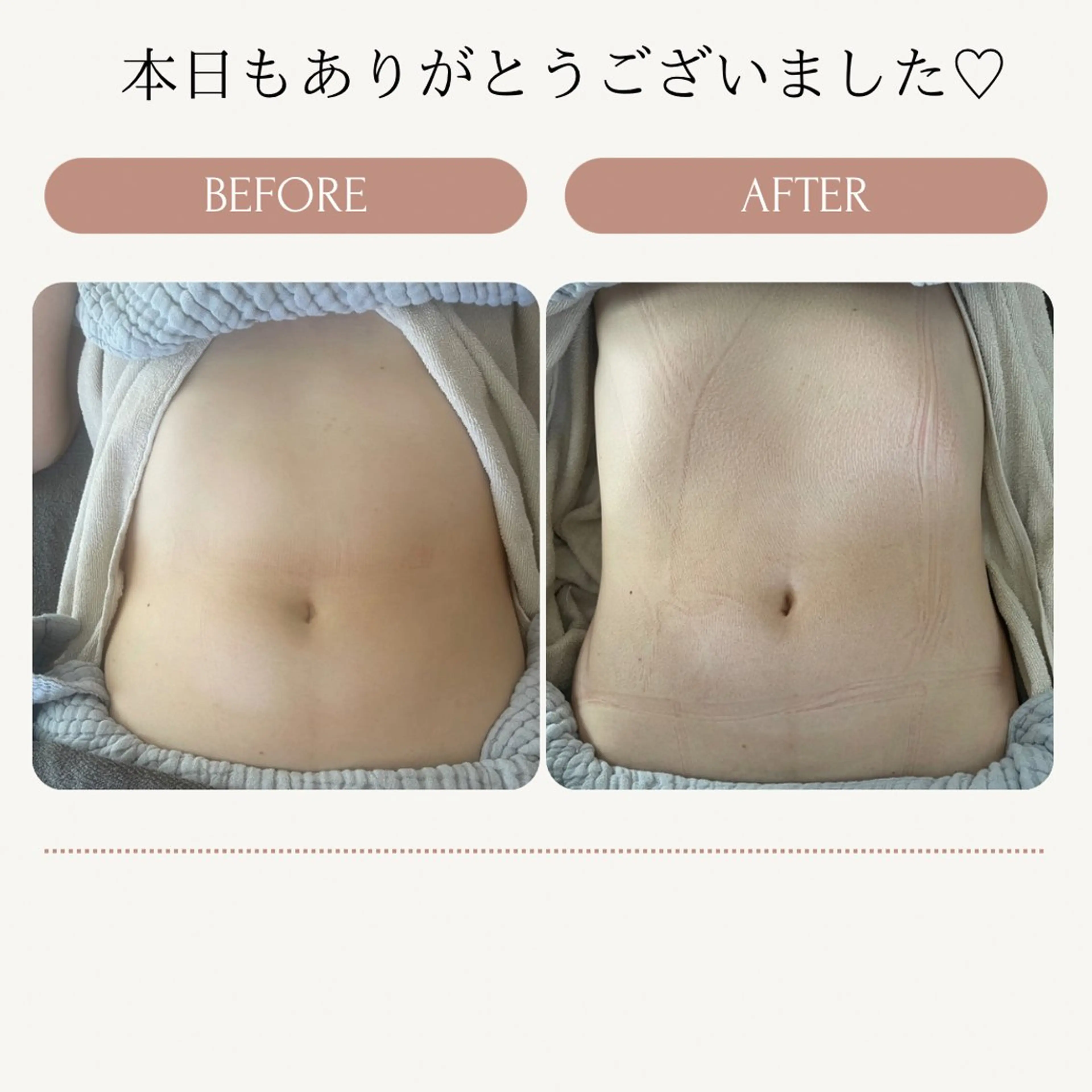 便秘薬なしでスルッと出せる身体への写真