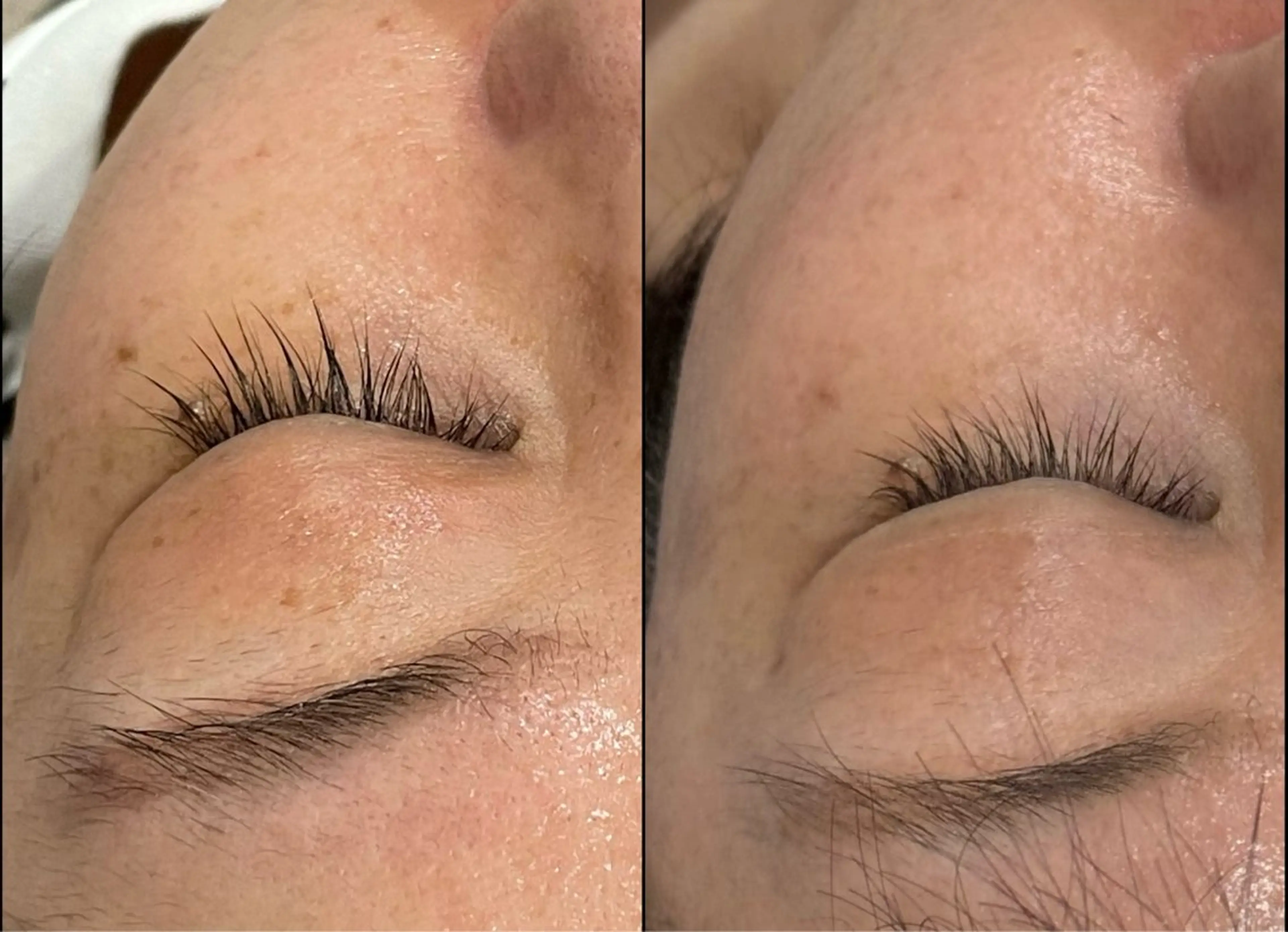 エステ LiZA エステティックサロンのエステ・リラクイメージ