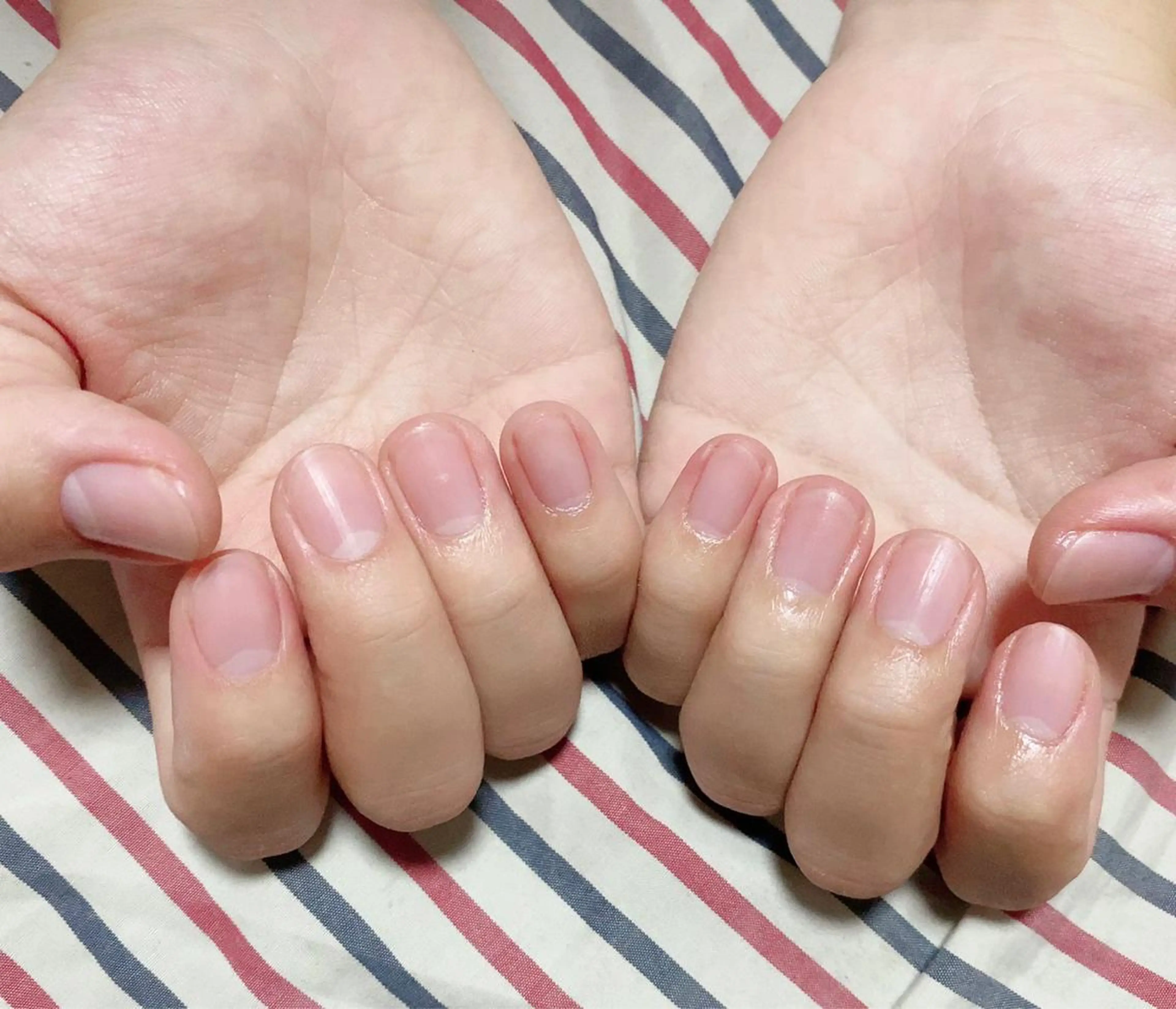 ネイルケアの写真