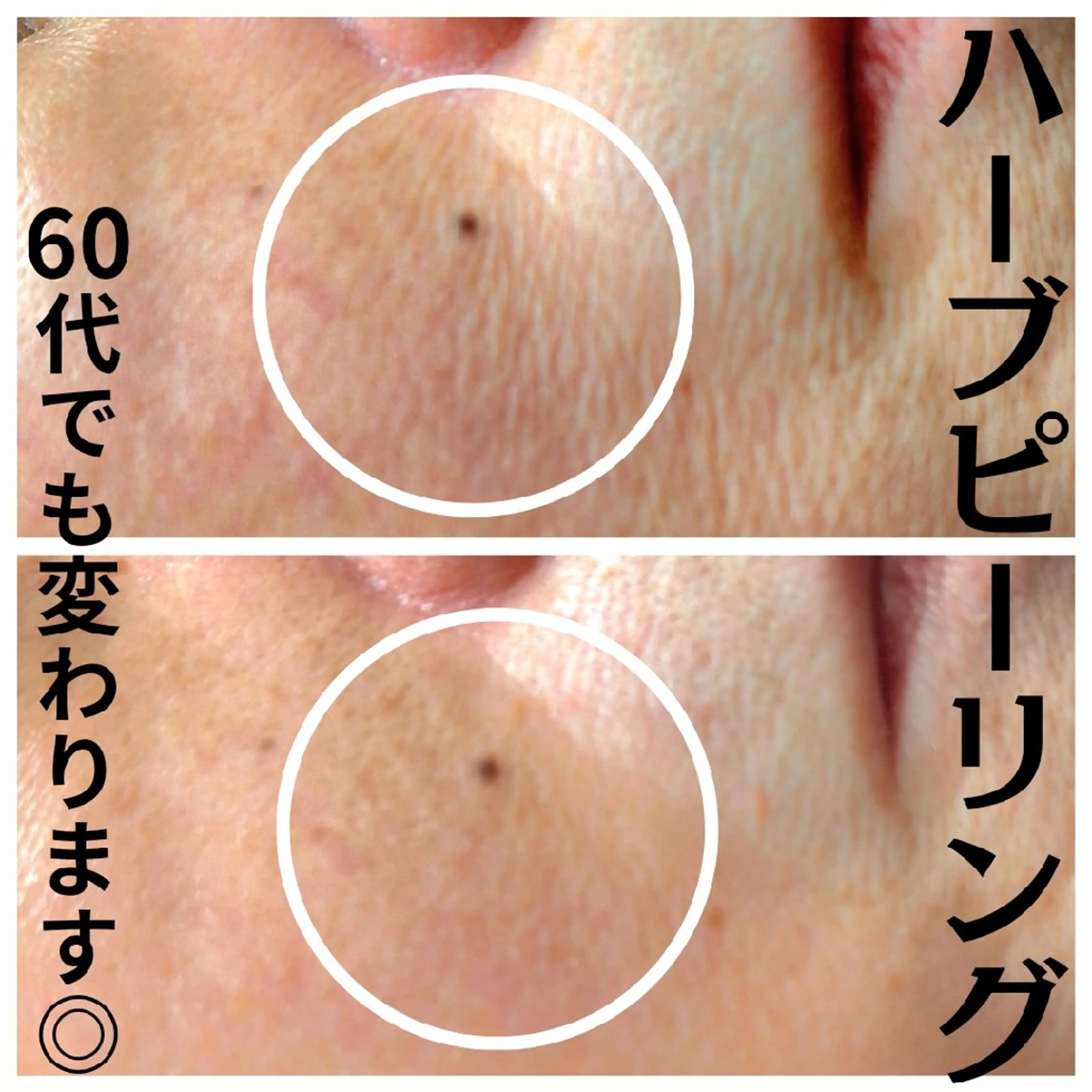 エステ フェイシャル専門サロ ン ERINのエステ・リラクイメージ