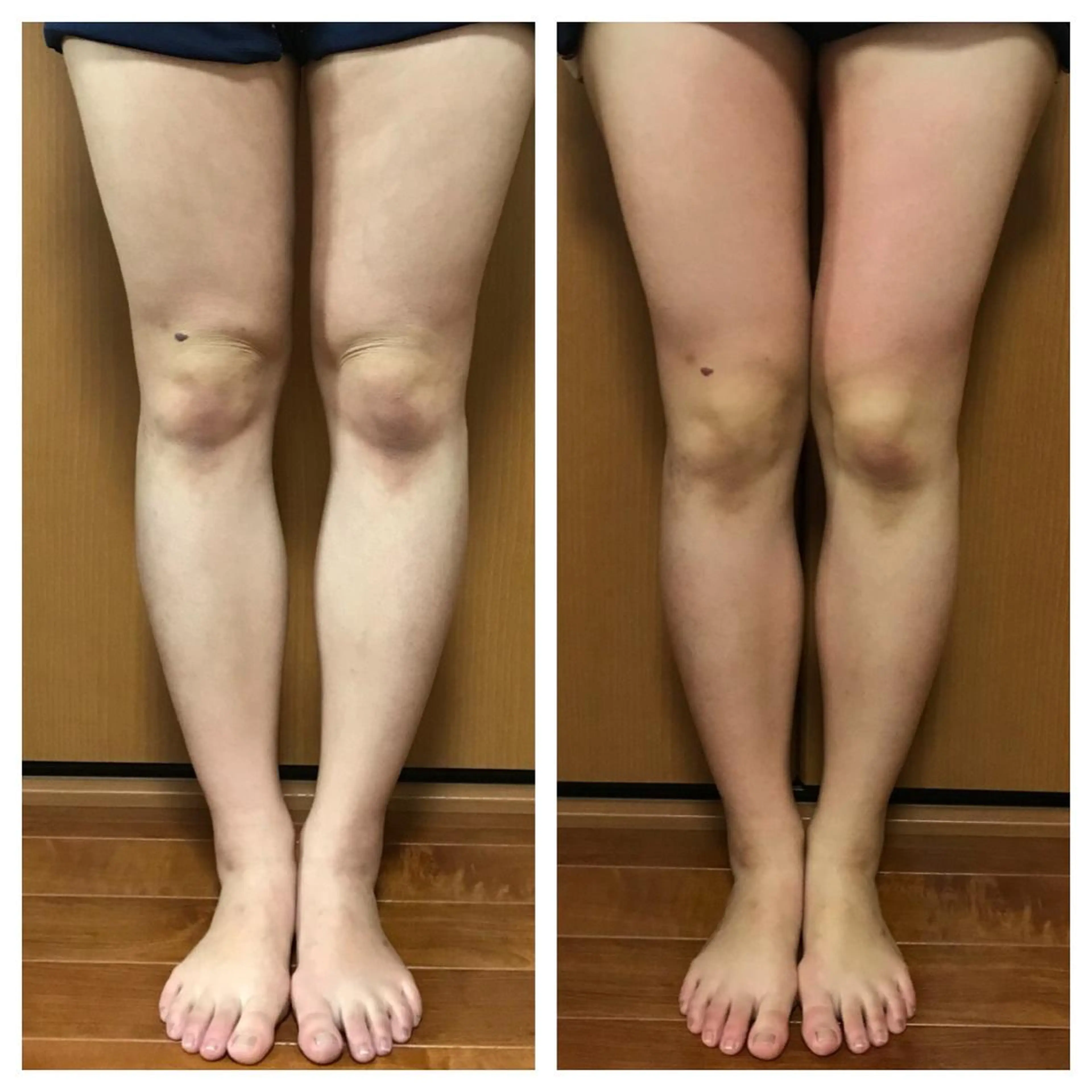 salon.plaisir（プレズィール）所属・酒井 瑠未のエステ・リラクイメージ