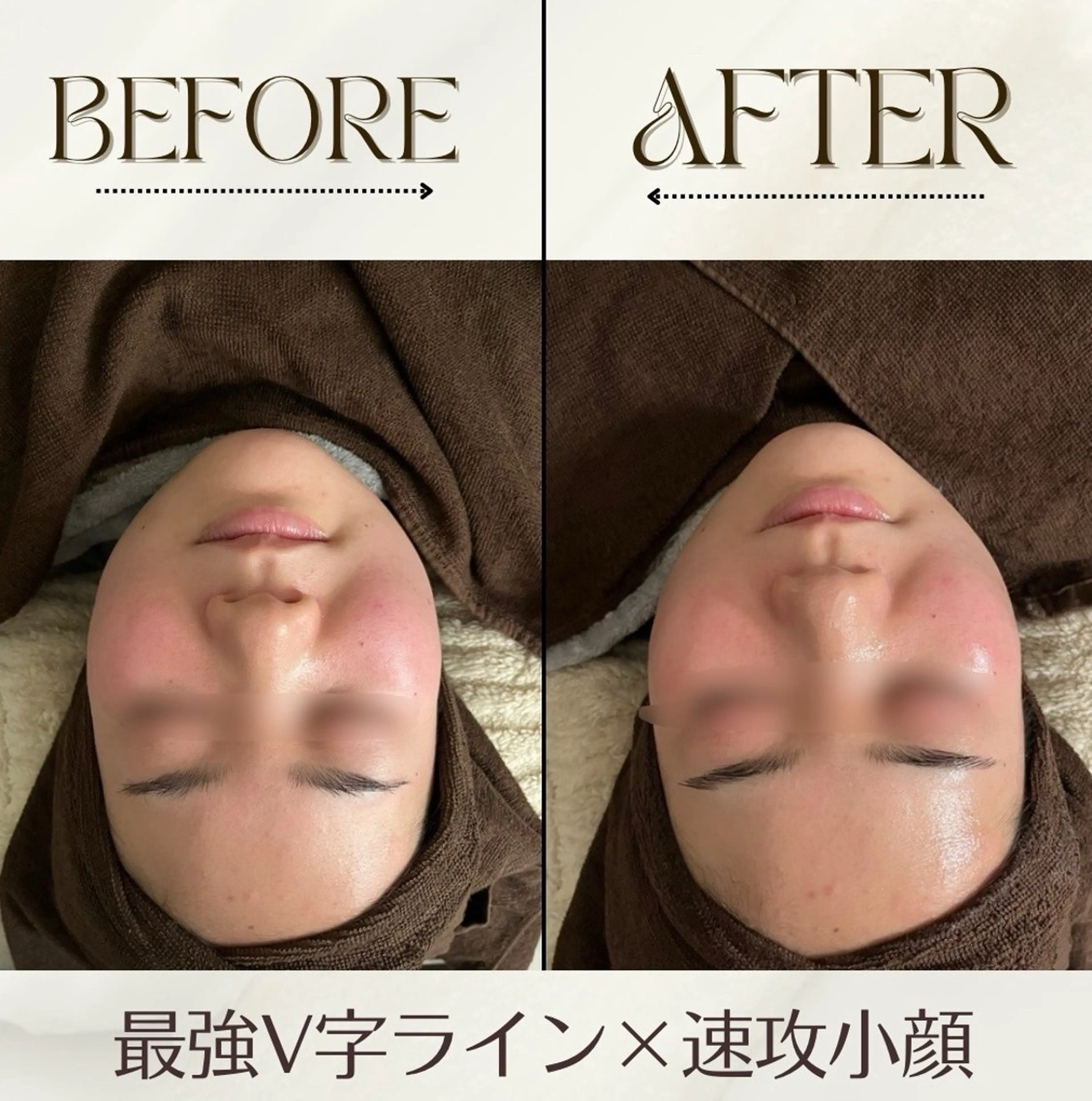 エステ 肩甲骨&全身オイル専門店　TENER 池袋所属・TENER 池袋 KANAKOのその他イメージ