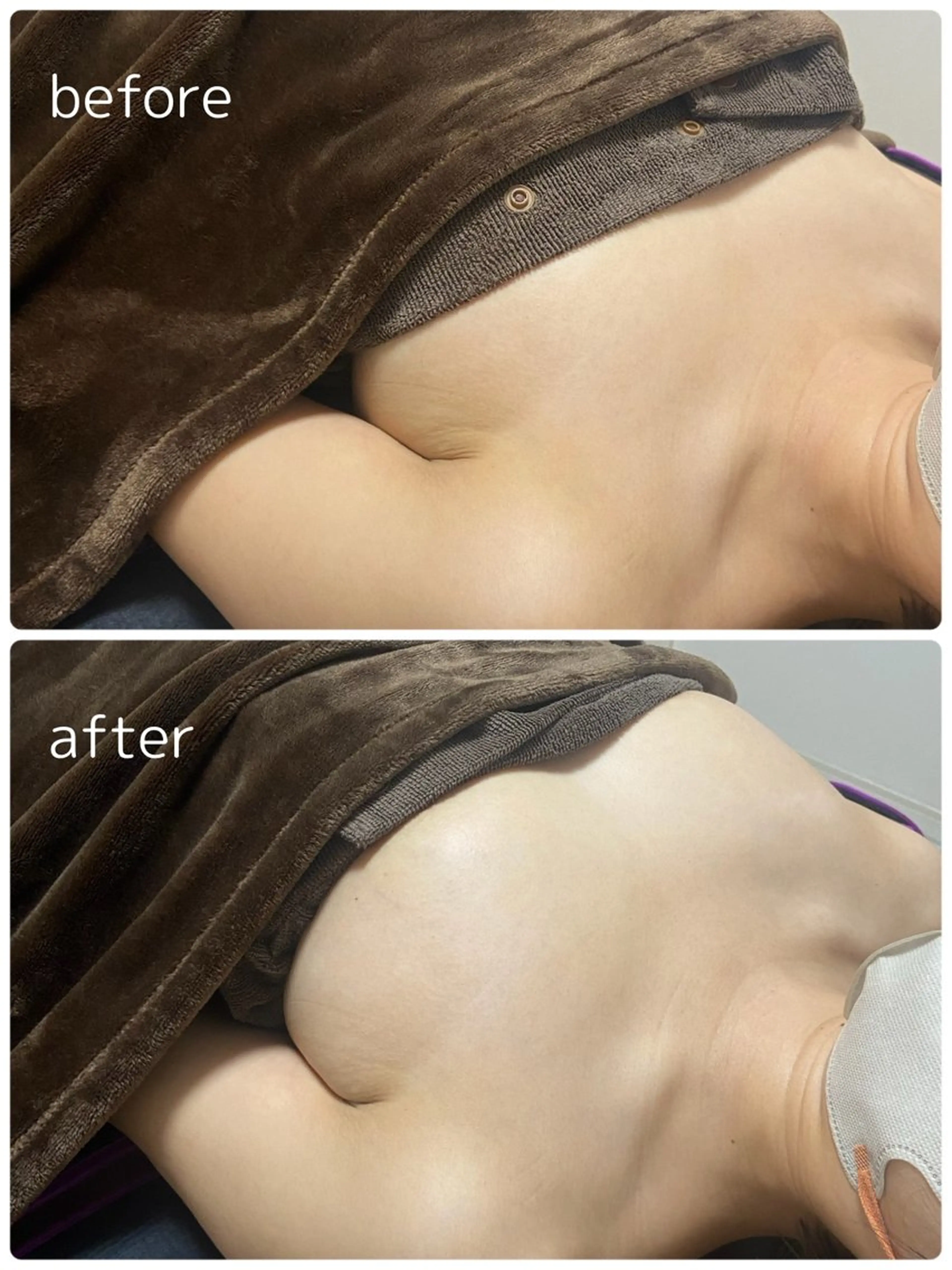 エステ 女性専用🌷Lily 有薗の眉毛・アイブロウイメージ