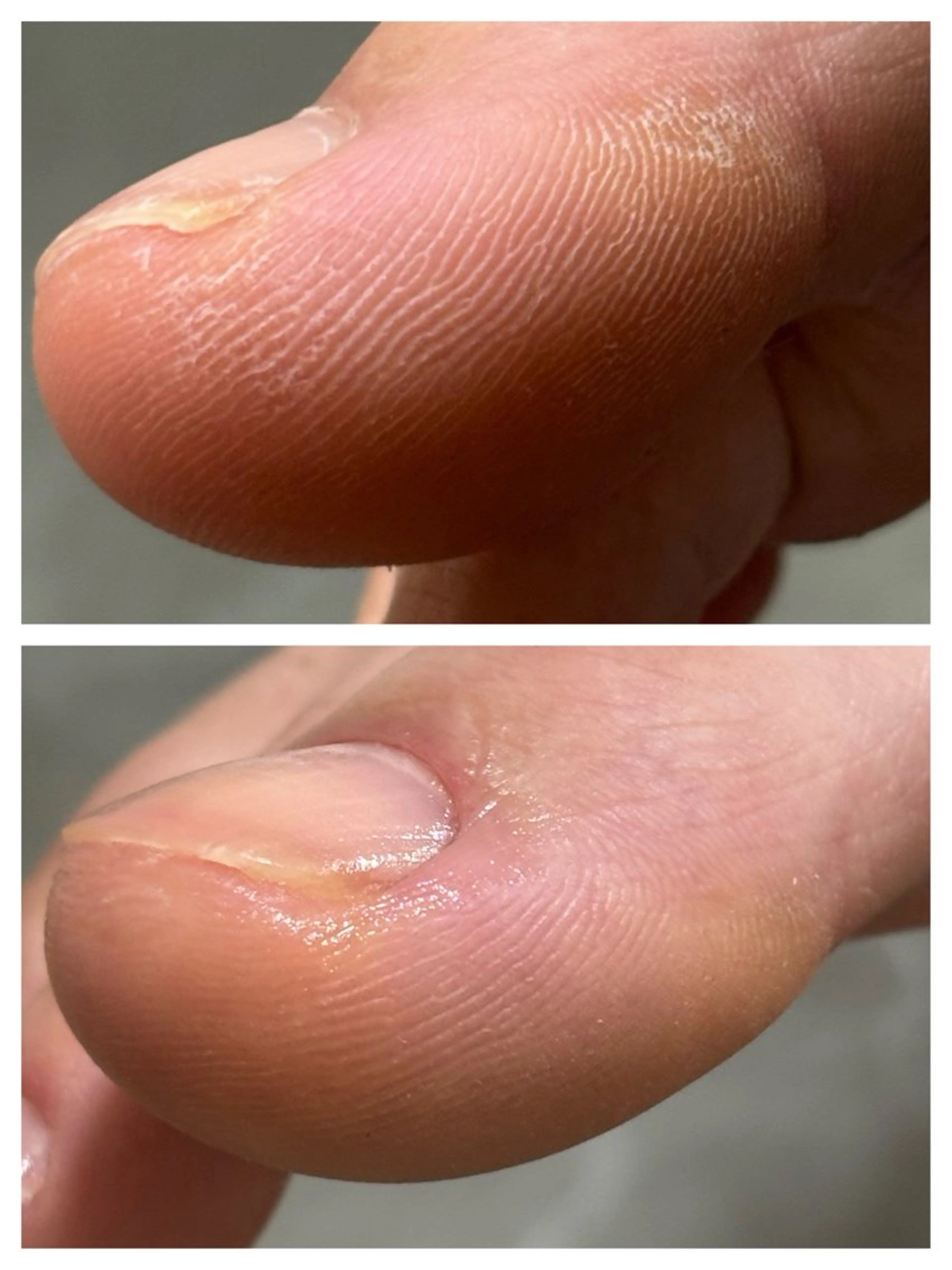 フットウォーターケアの写真