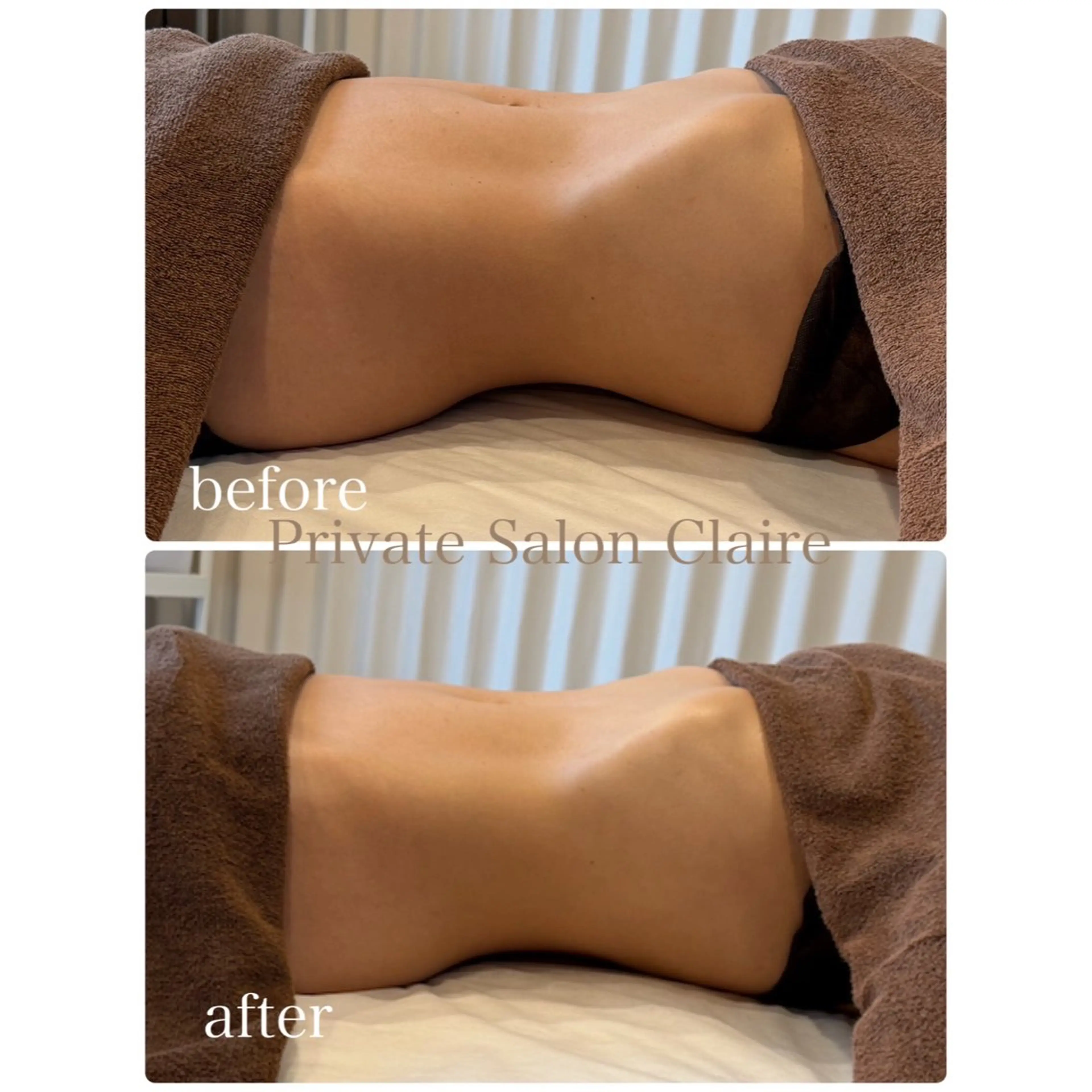 体の中から肌質改善 クレール　奈良のエステ・リラクイメージ