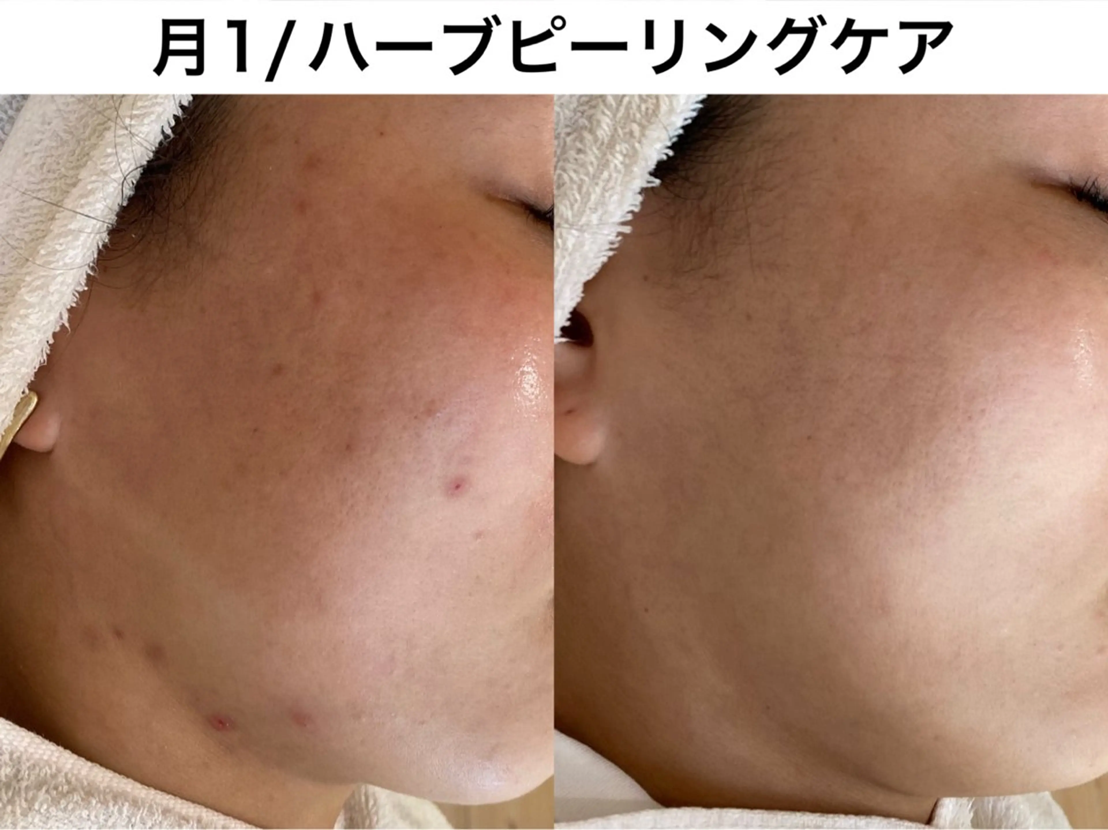 TRINIENCE 南流山店のエステ・リラクイメージ