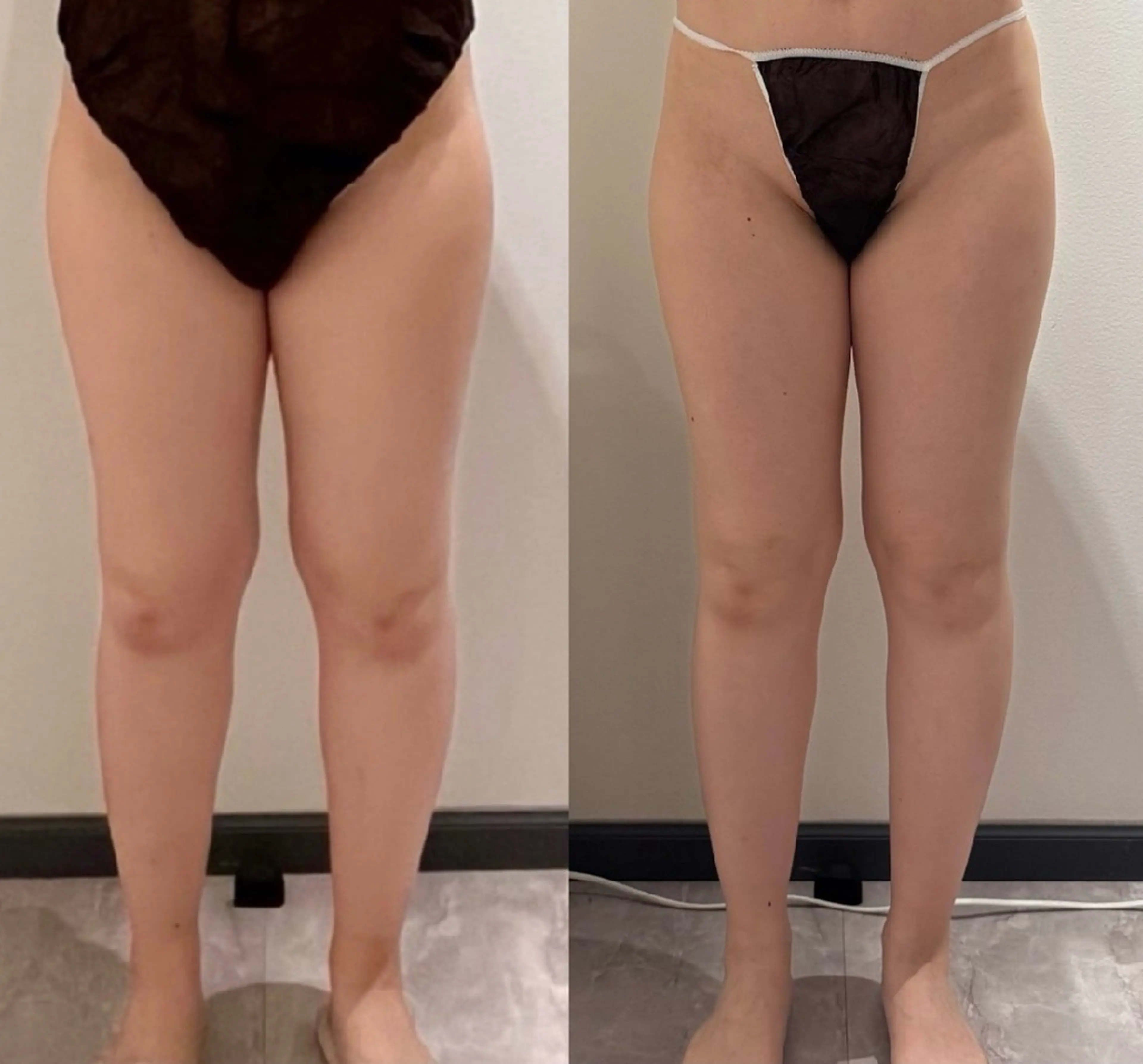 sii MIUのその他イメージ