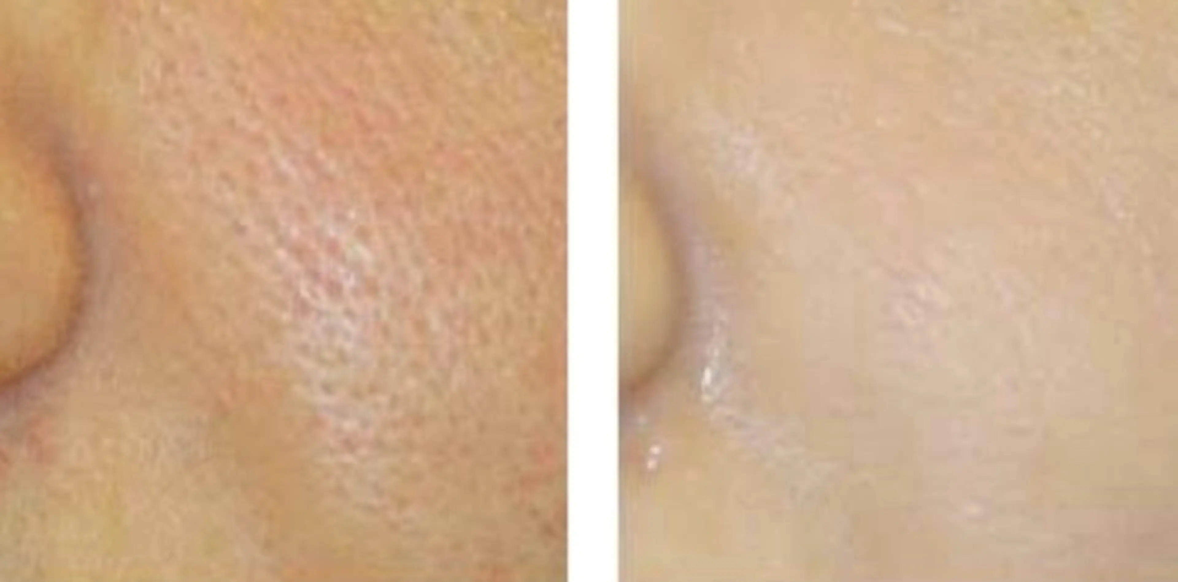 salon merci和泉のエステ・リラクイメージ