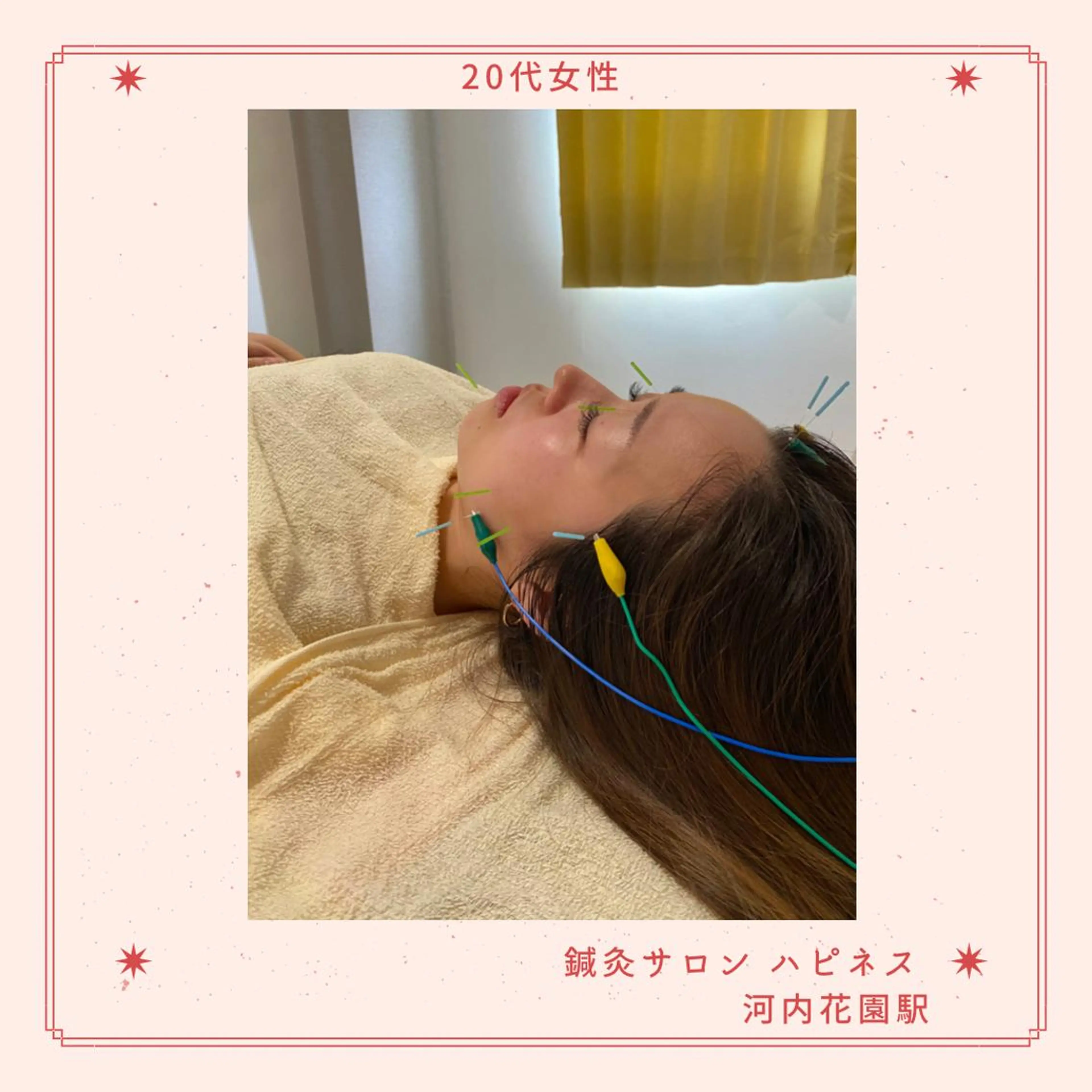 美容鍼サロン ハピネス所属・土手 真矢のその他イメージ