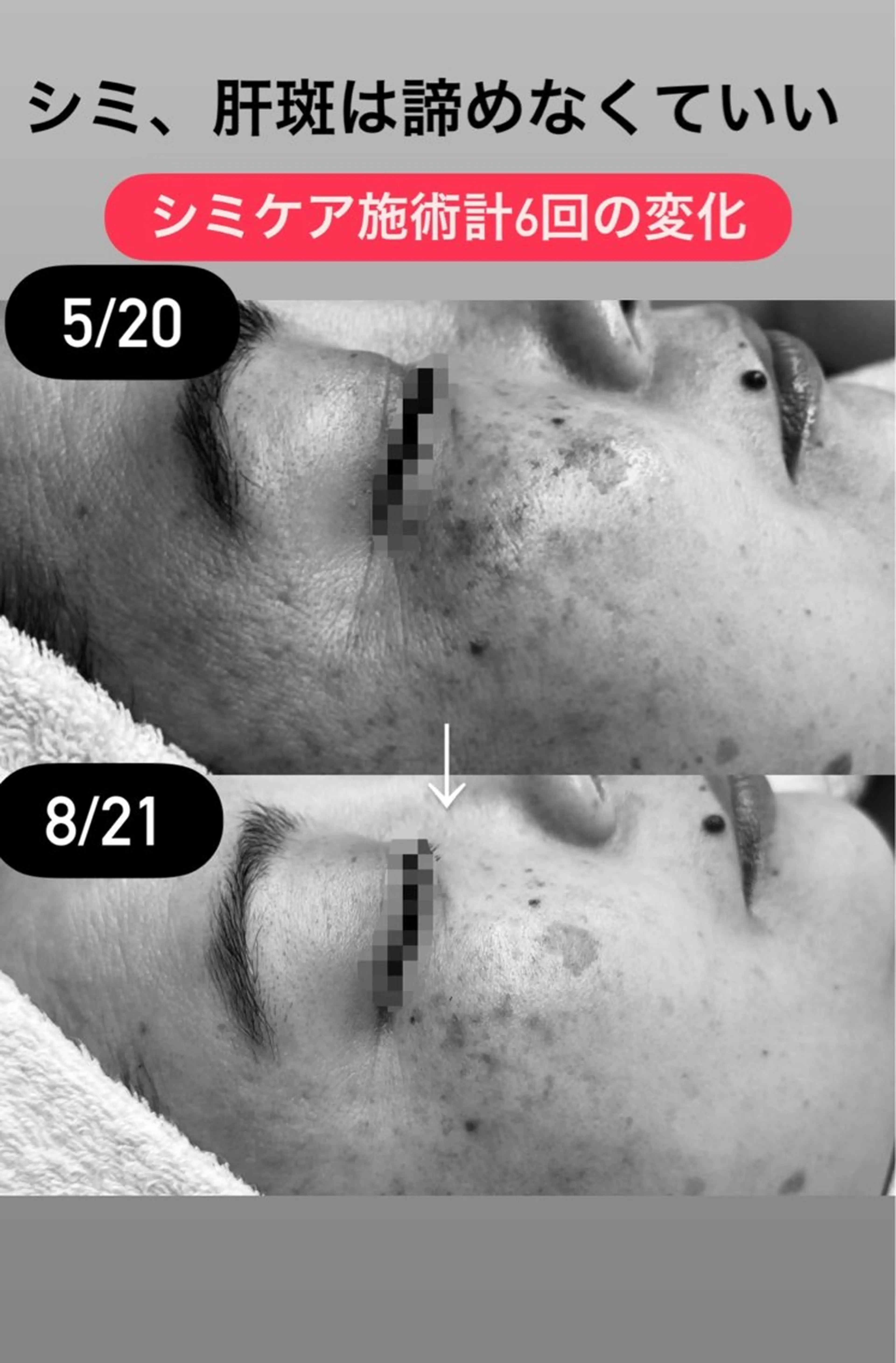 HINA/産毛脱毛・ 肌質改善専門サロンのエステ・リラクイメージ