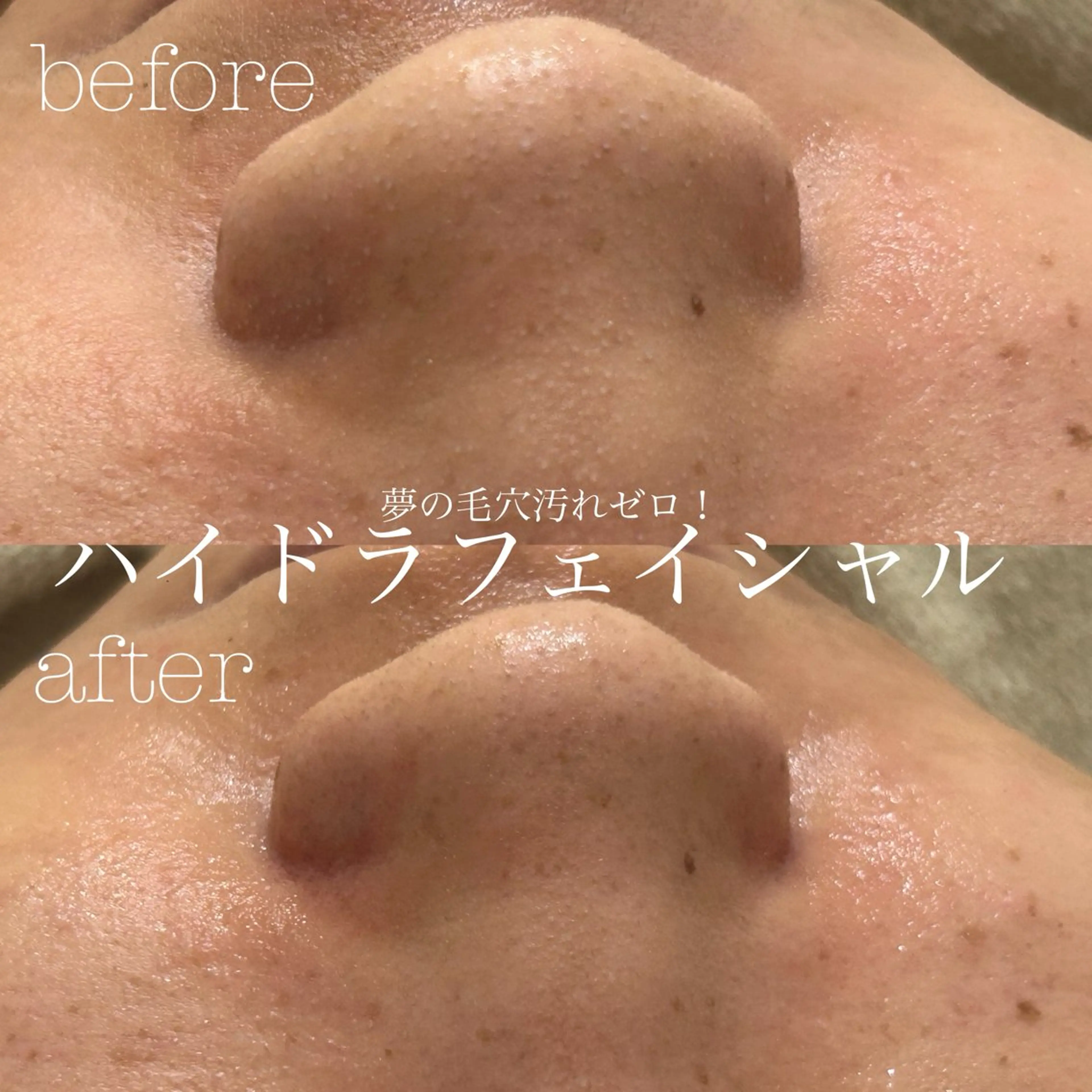 エステ フェイシャルサロン CHIARA 荒田のエステ・リラクイメージ