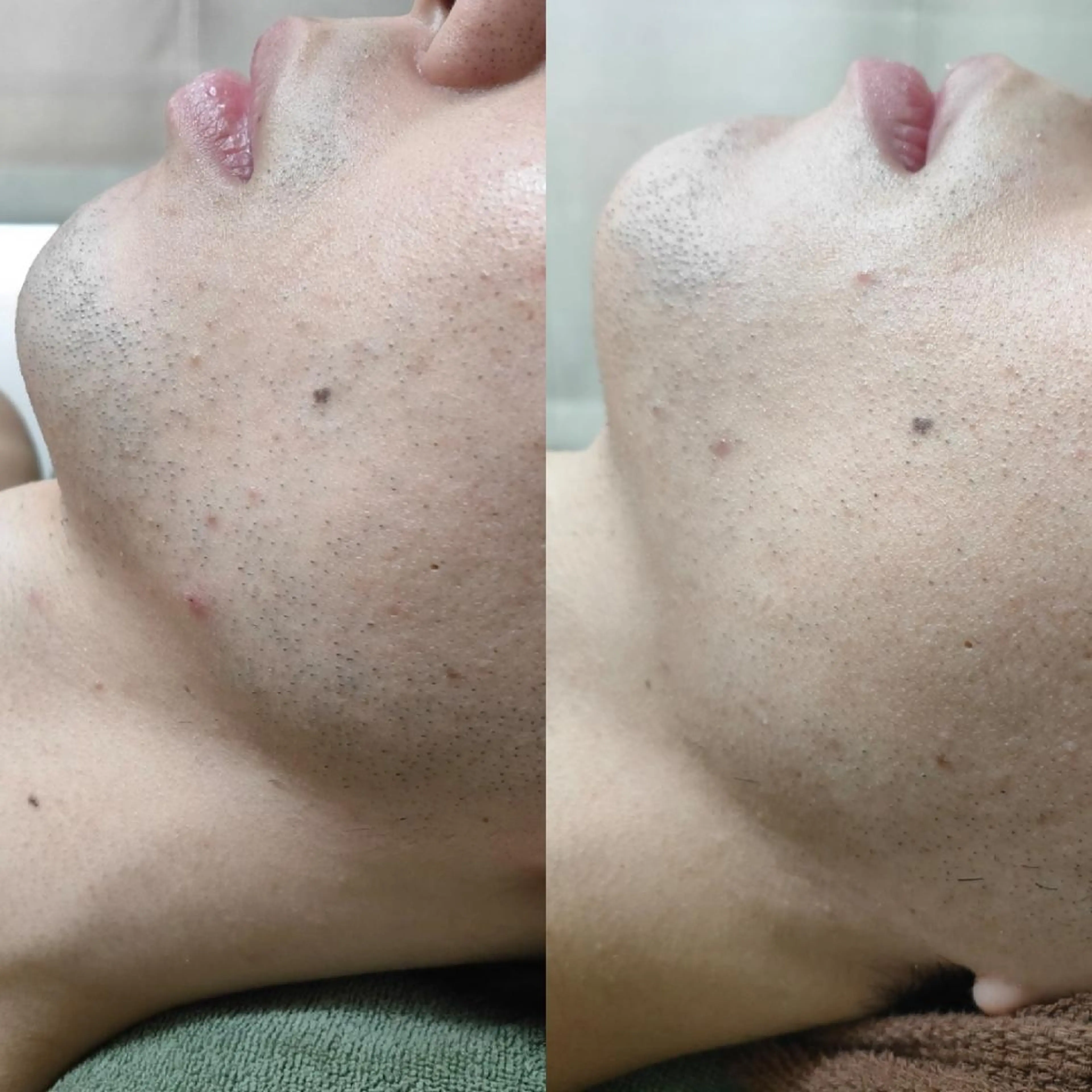 メンズ 武 藤のエステ・リラクイメージ