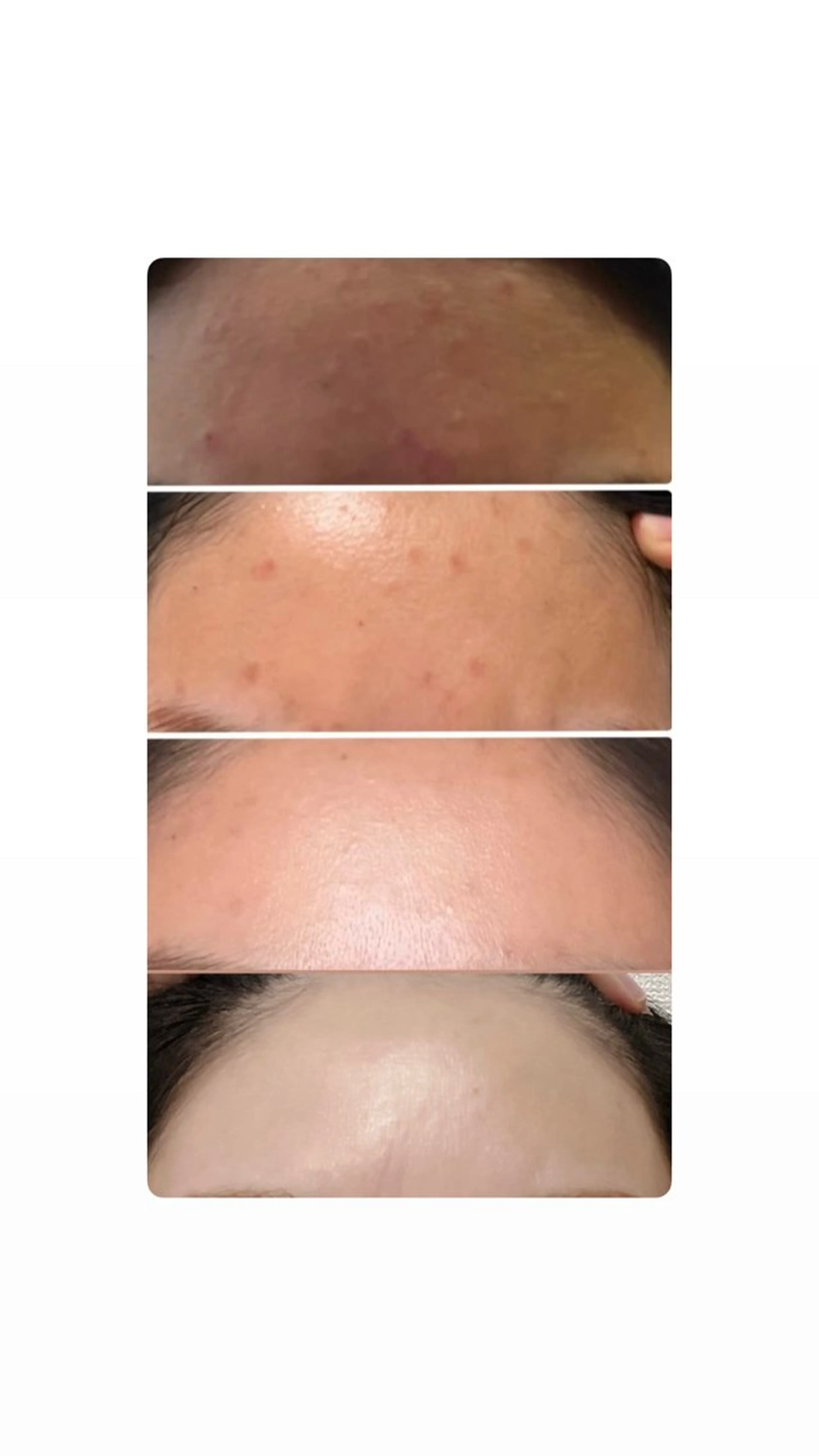 blossom山内店 (ブロッサム山内店)所属・la　salon. chihoriのエステ・リラクイメージ