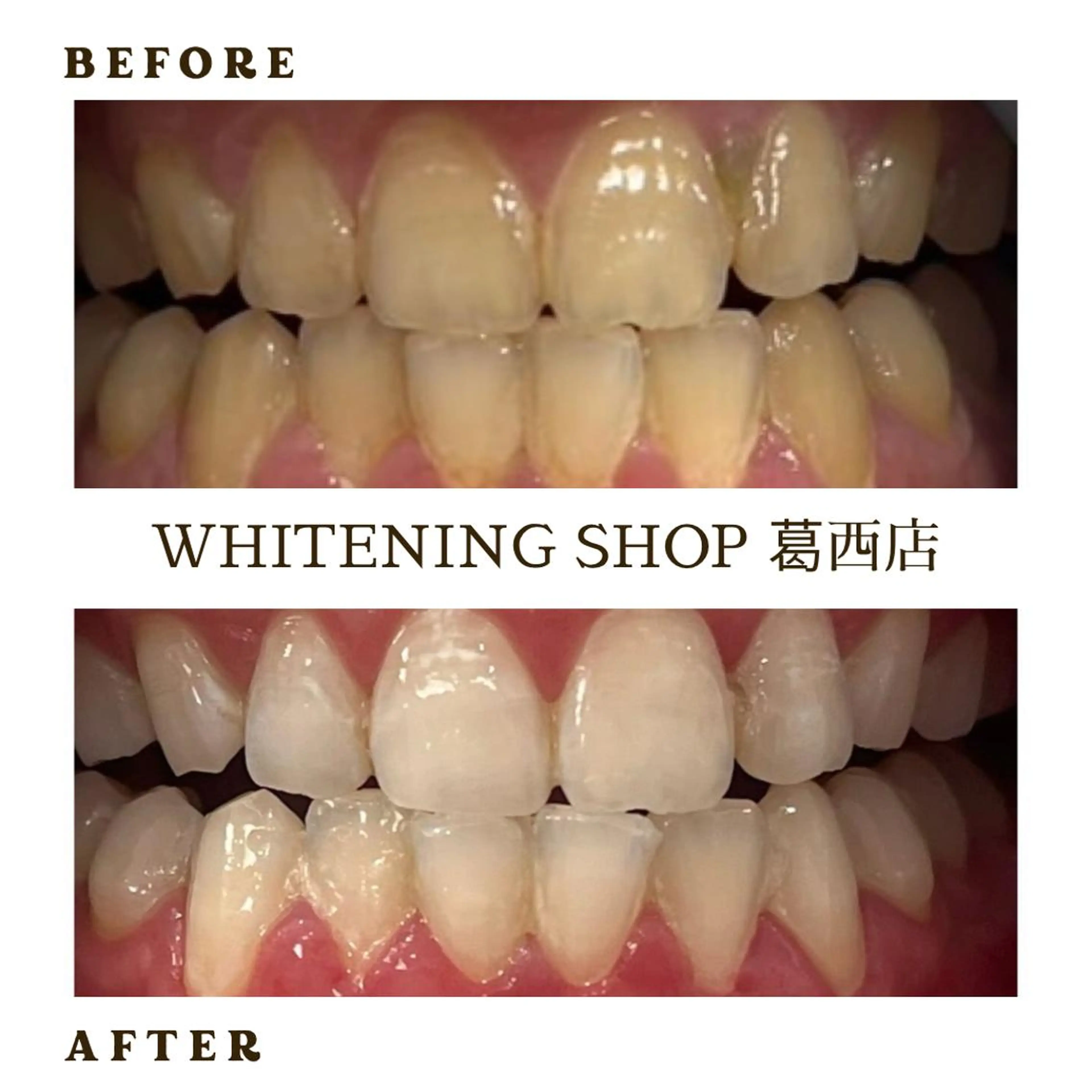 メンズ その他 ホワイトニング ショップ葛西店のその他イメージ