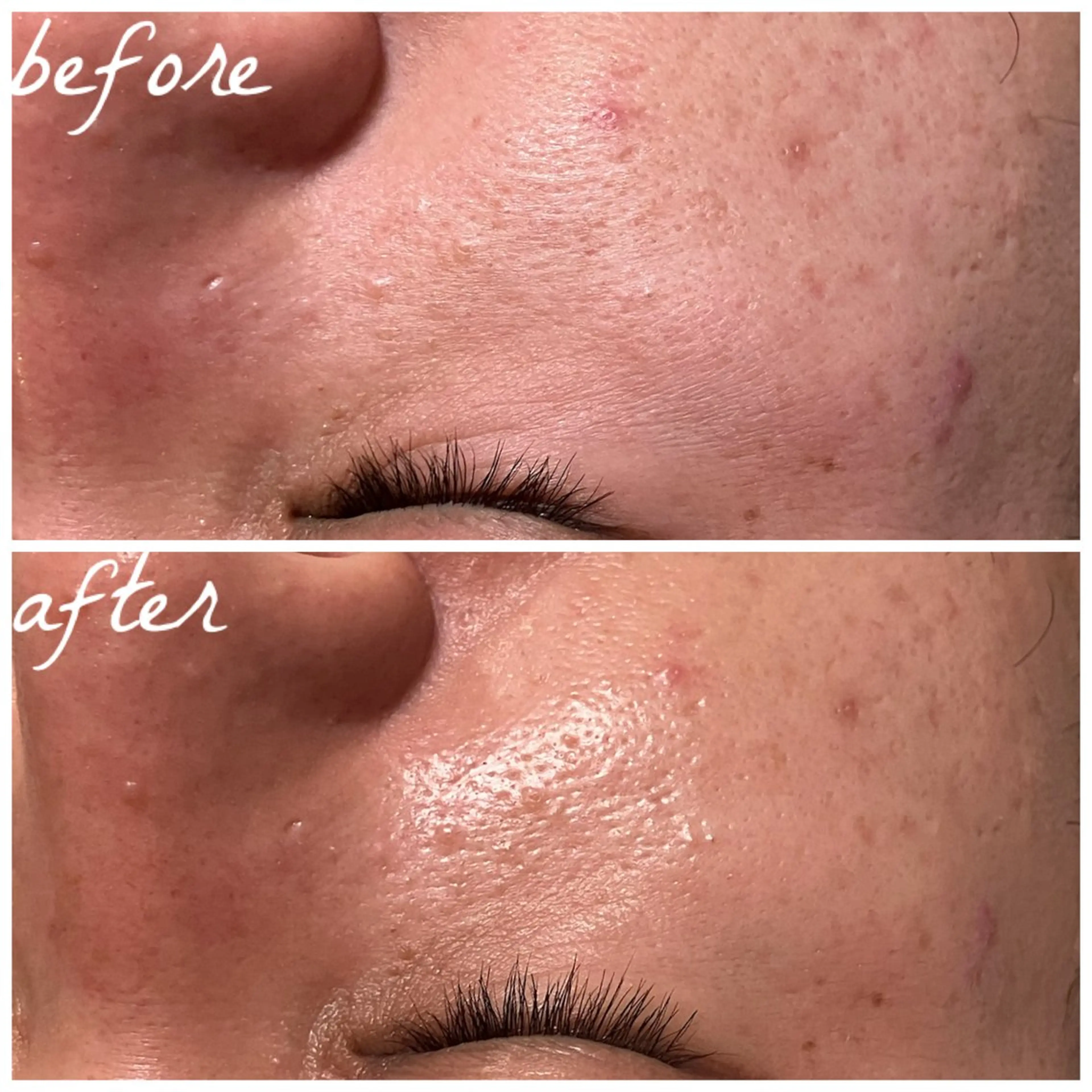 メンズ メナード岐阜茜部 杉浦のエステ・リラクイメージ