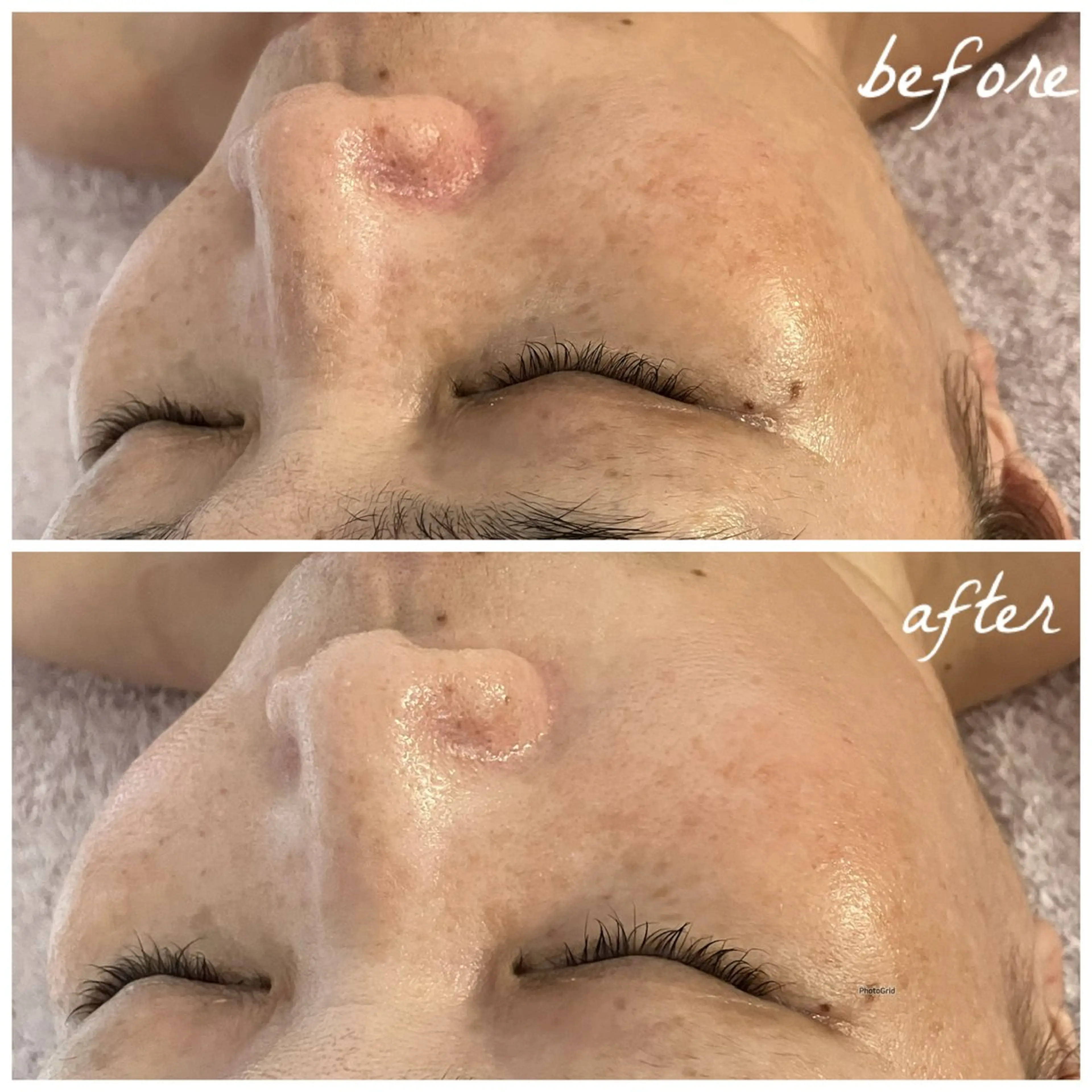 メンズ エステ メナード岐阜茜部 杉浦のエステ・リラクイメージ