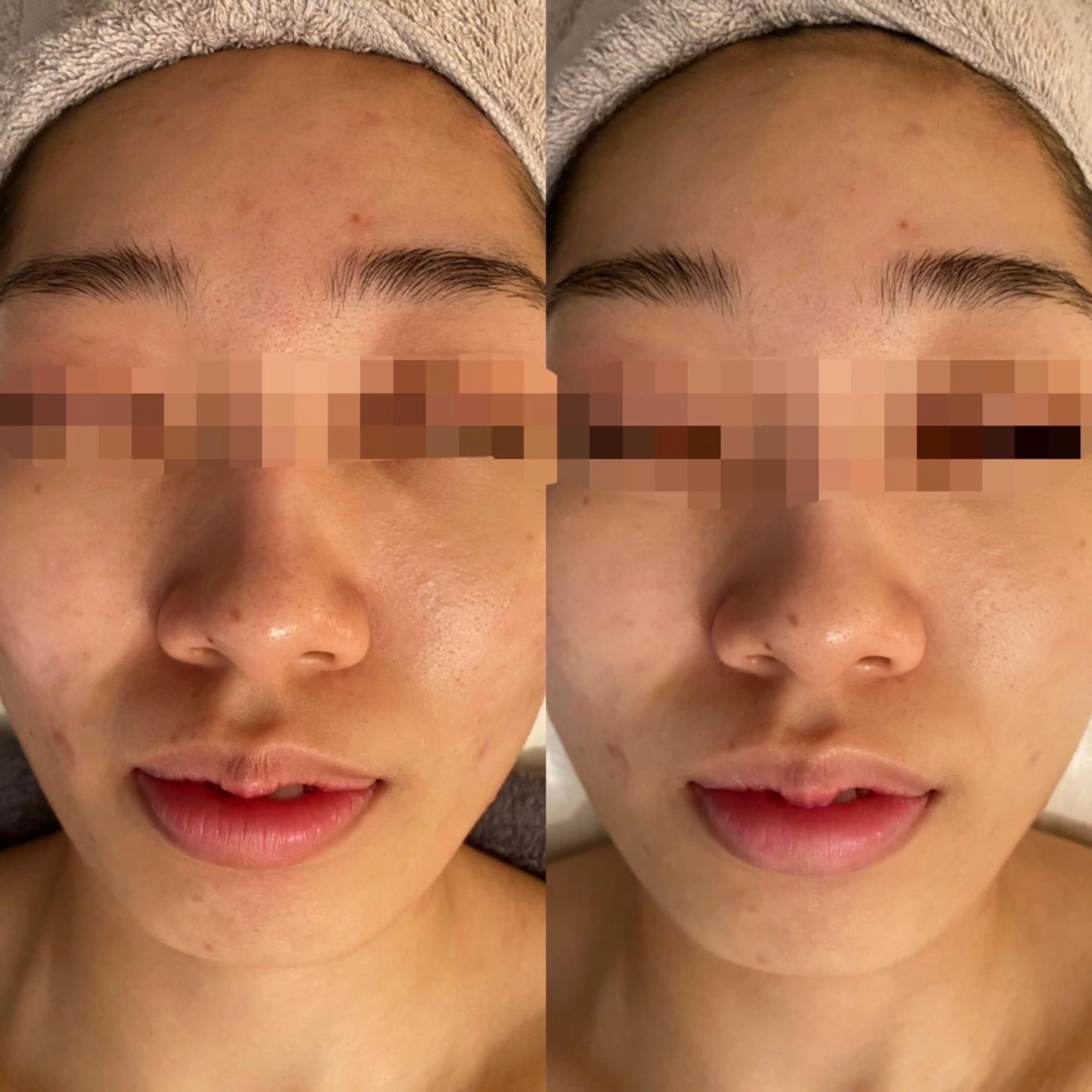 エステ リラク 田中For..天王寺 肌質改善/よもぎ蒸しのエステ・リラクイメージ