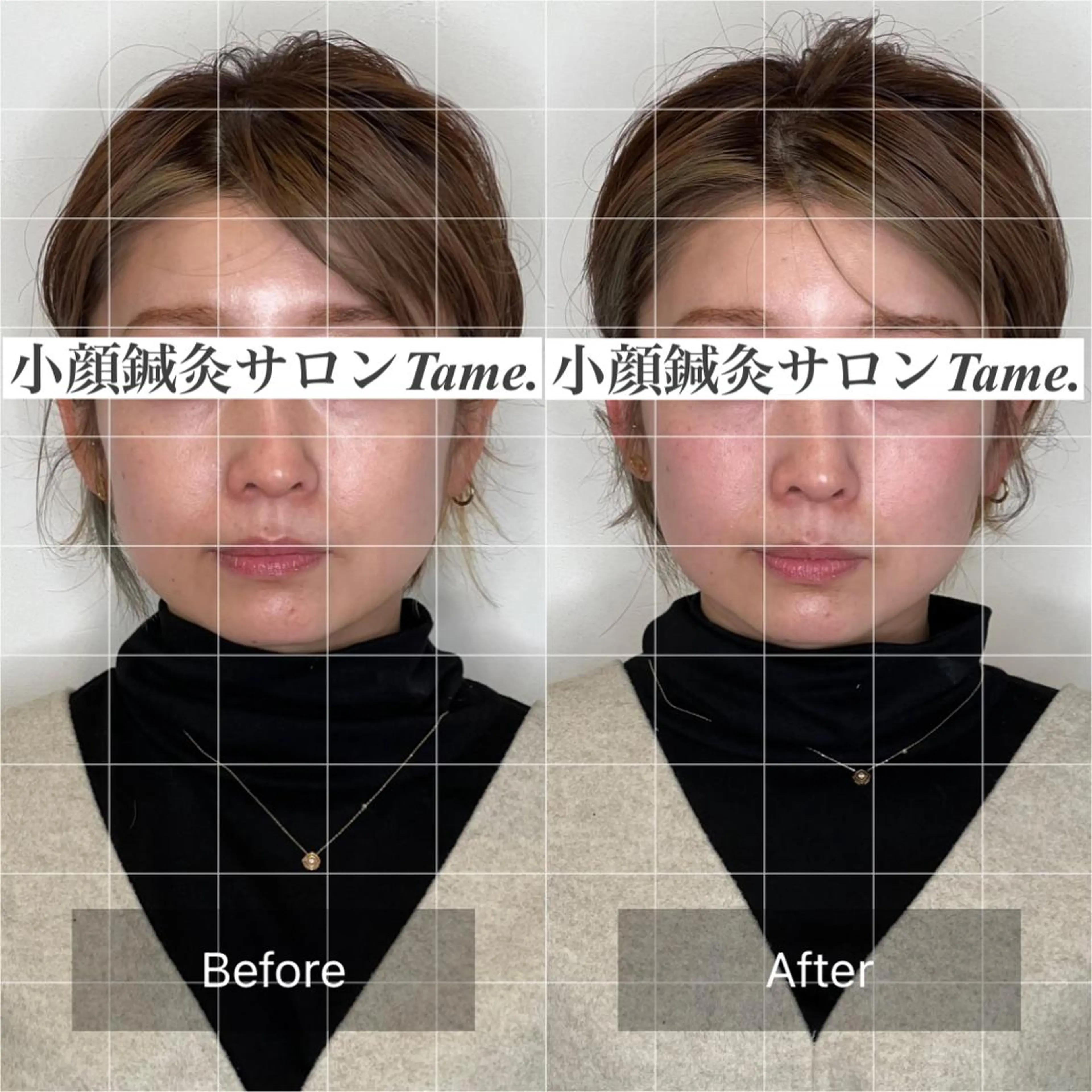 エステ Lenne所属・佐藤 彰太のエステ・リラクイメージ