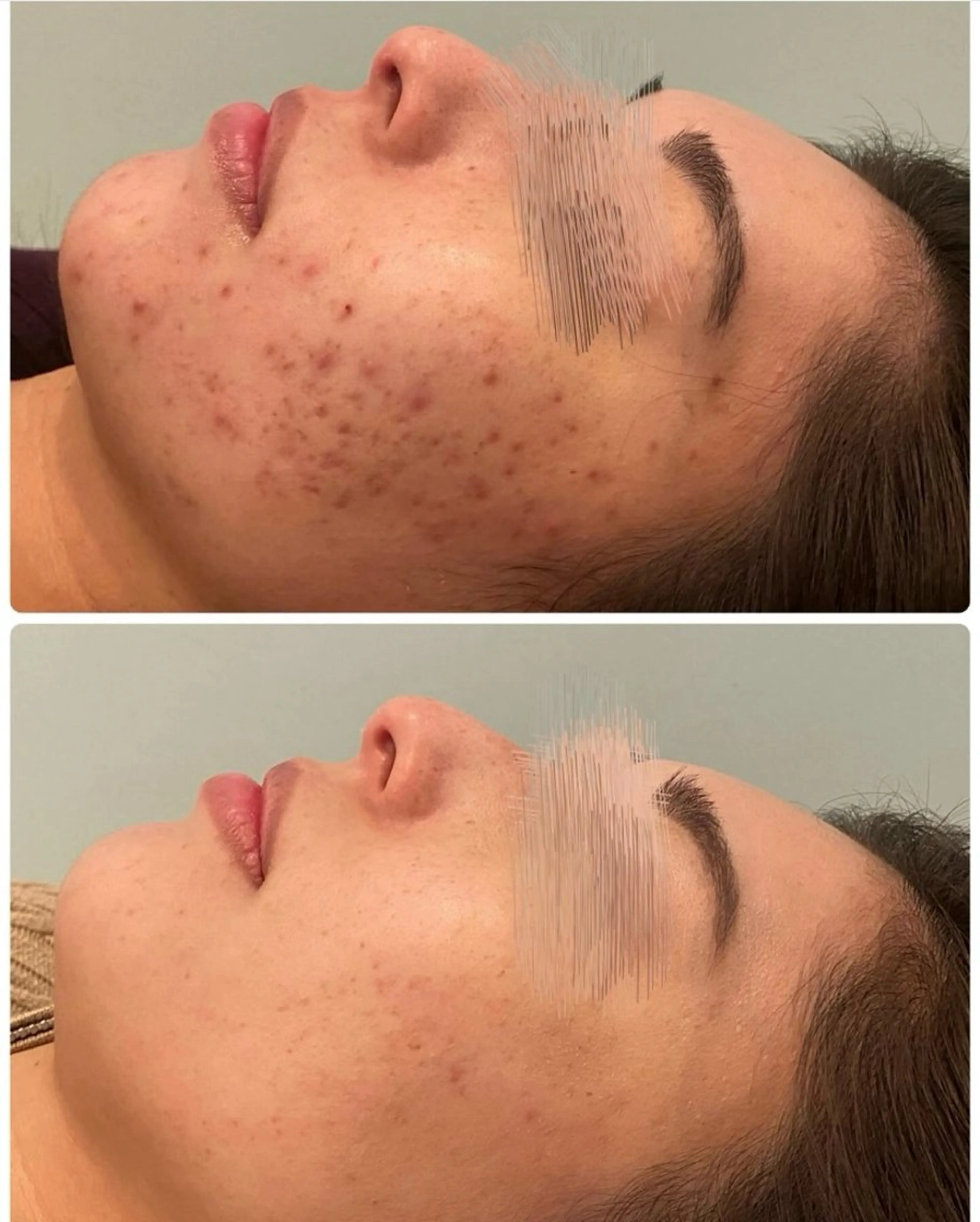 エステ ハーブピーリング専門 BIOPLUS＋川崎のエステ・リラクイメージ