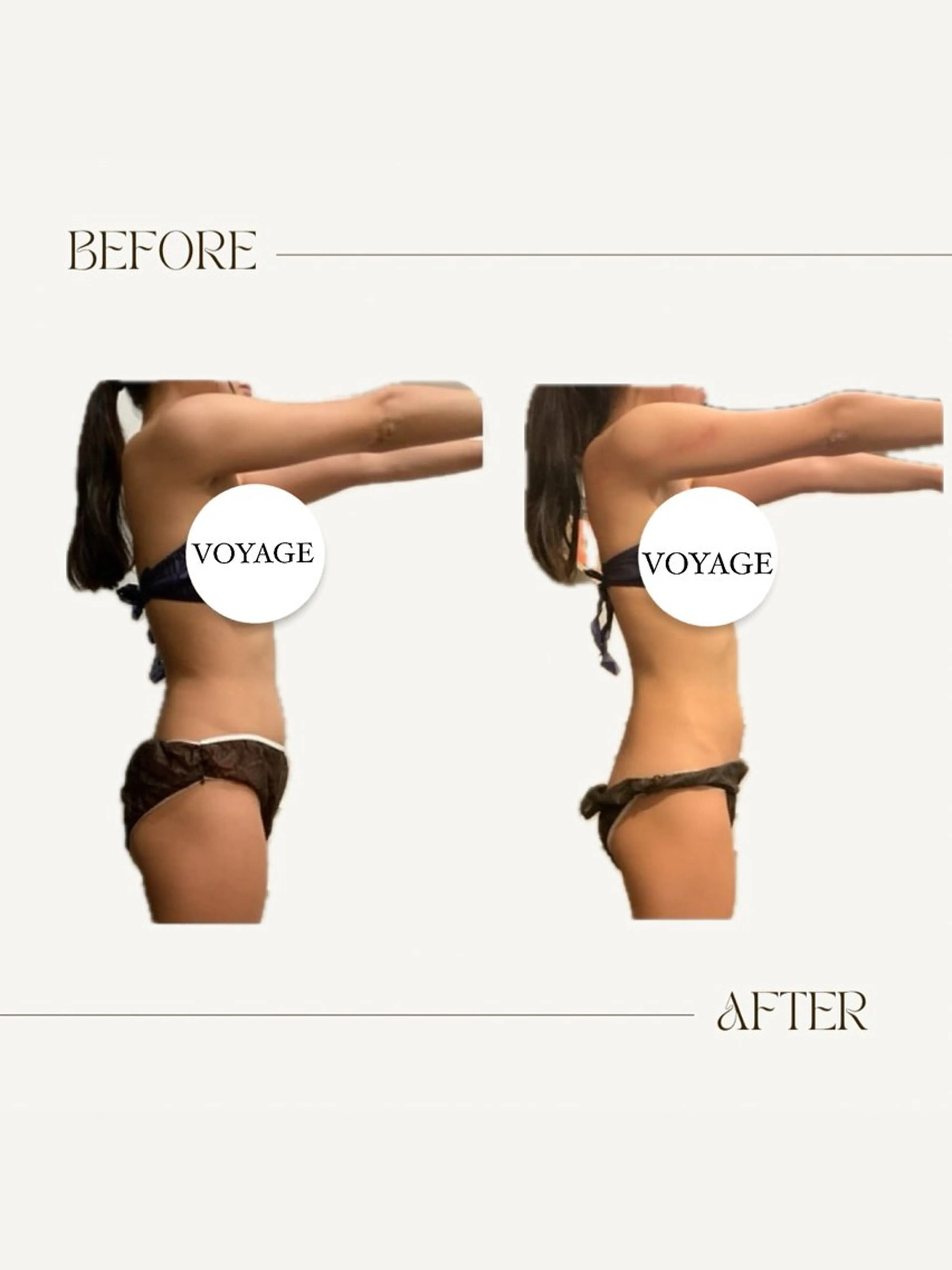 VOYAGE所属・圧倒的効果❤️‍🔥 VOYAGE ヤマダのエステ・リラクイメージ