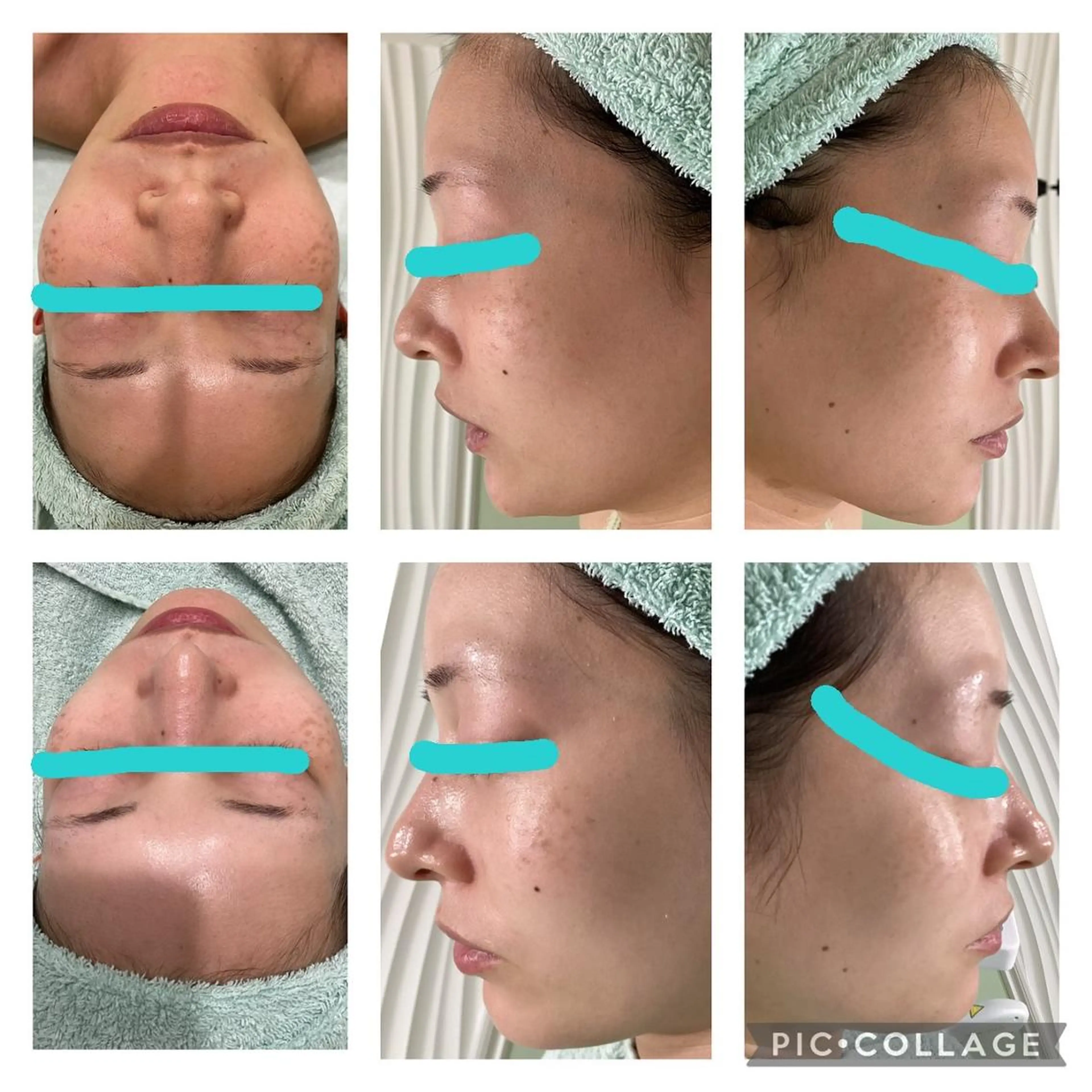 脱毛サロン ミュー松山本店のエステ・リラクイメージ