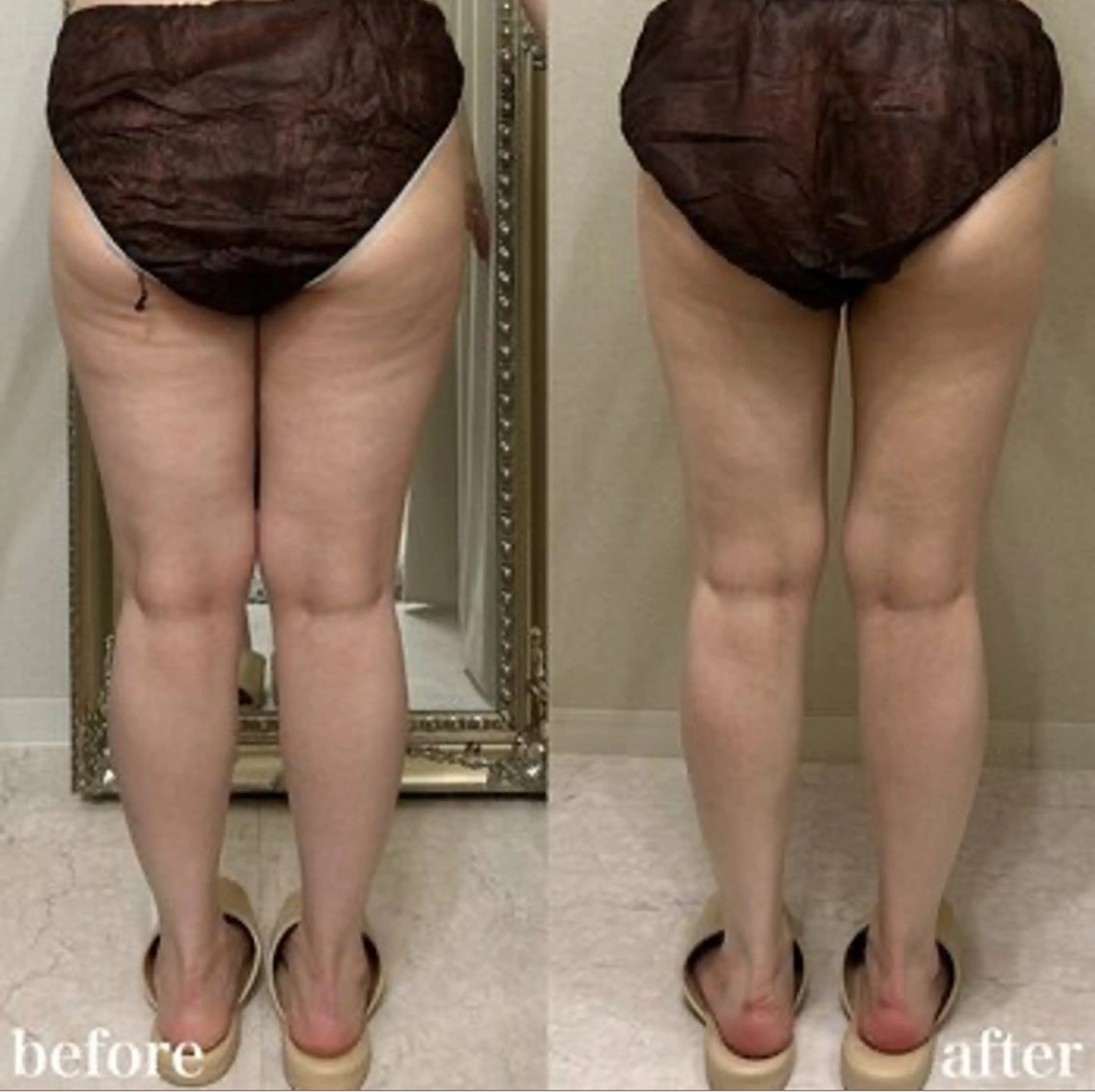 12月限定🎅🏻🎁下半身｜ハイパーナイフ40分の写真