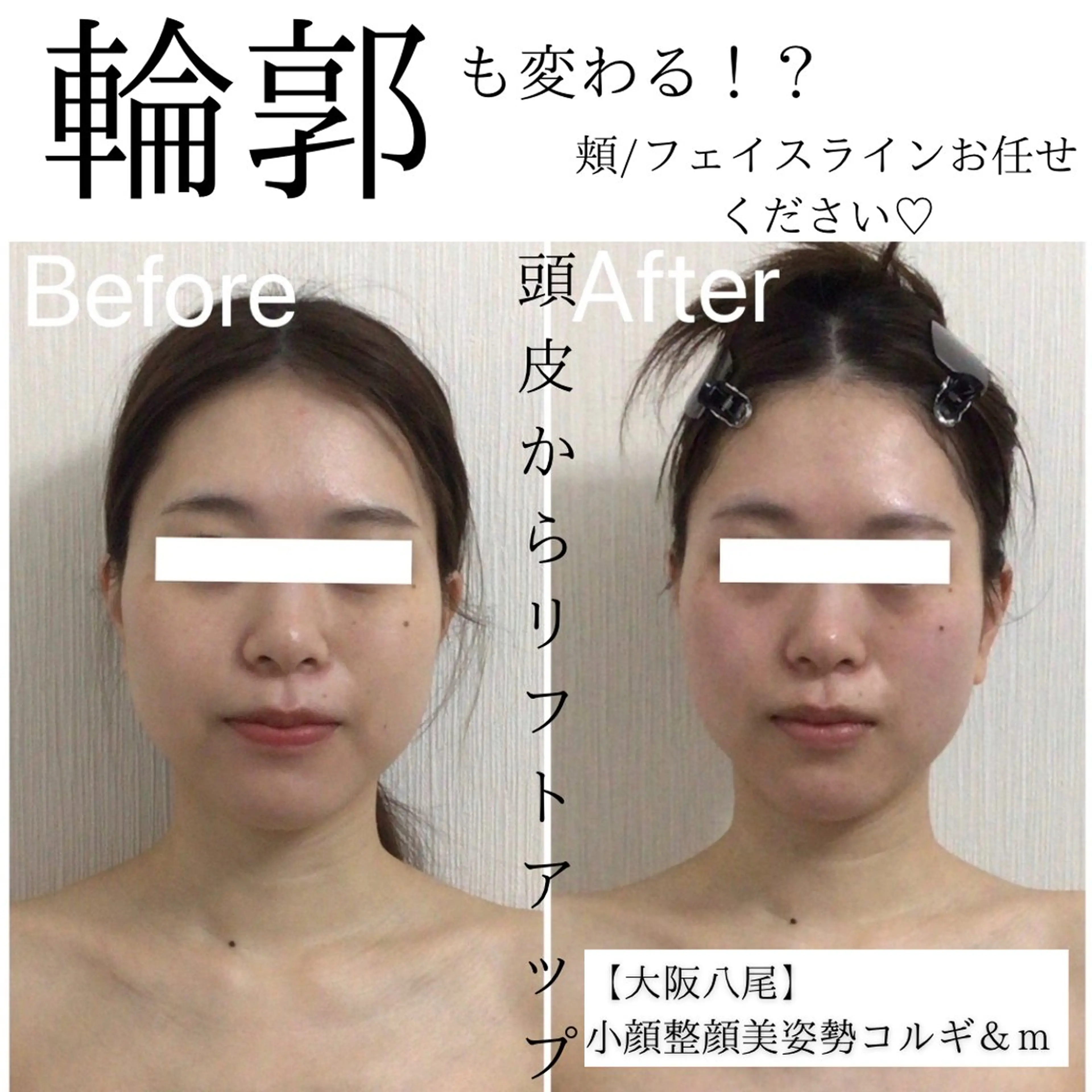 【人気No.1】小顔コルギ60分の写真