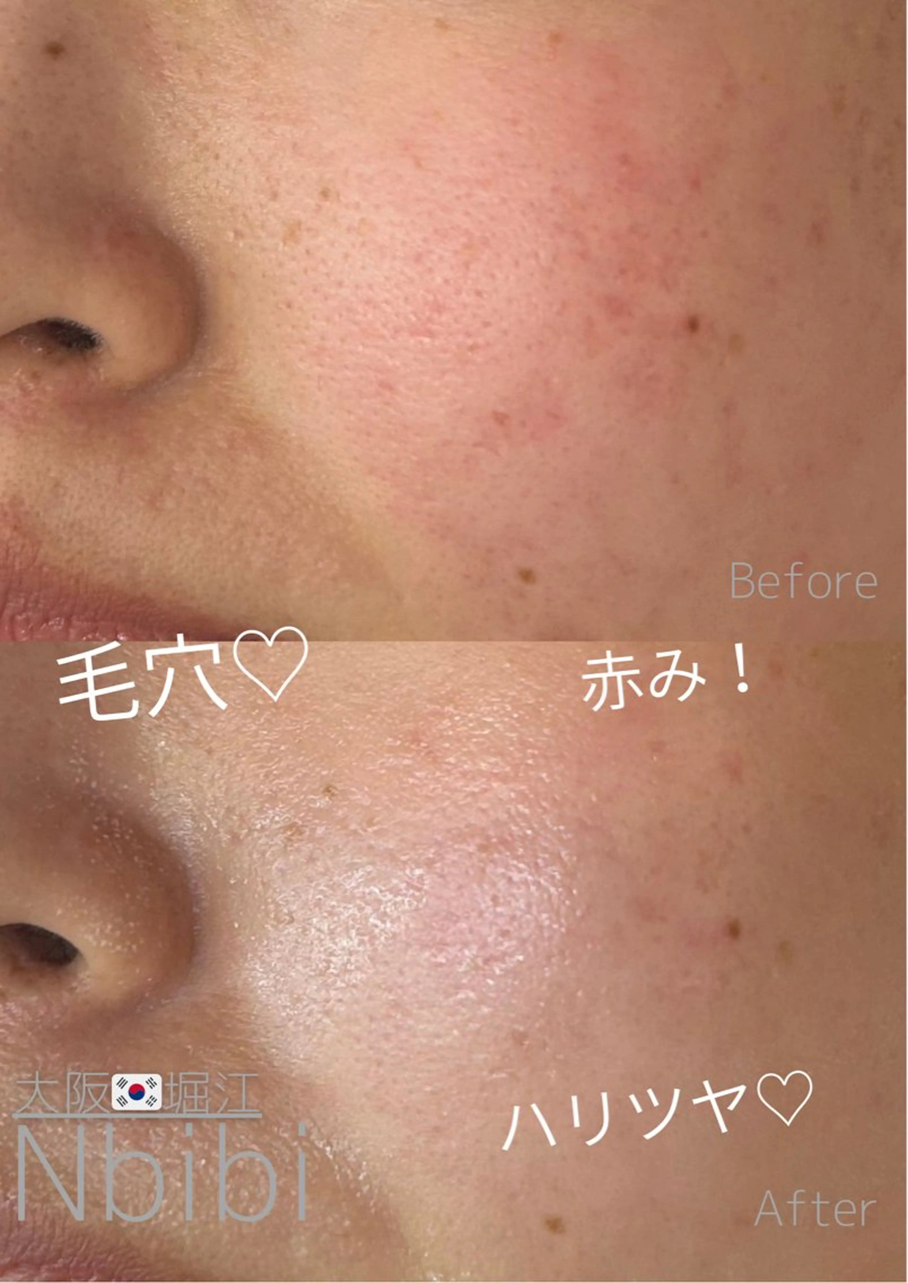 エステ 韓国🇰🇷価格 サロン_Nbibiのエステ・リラクイメージ