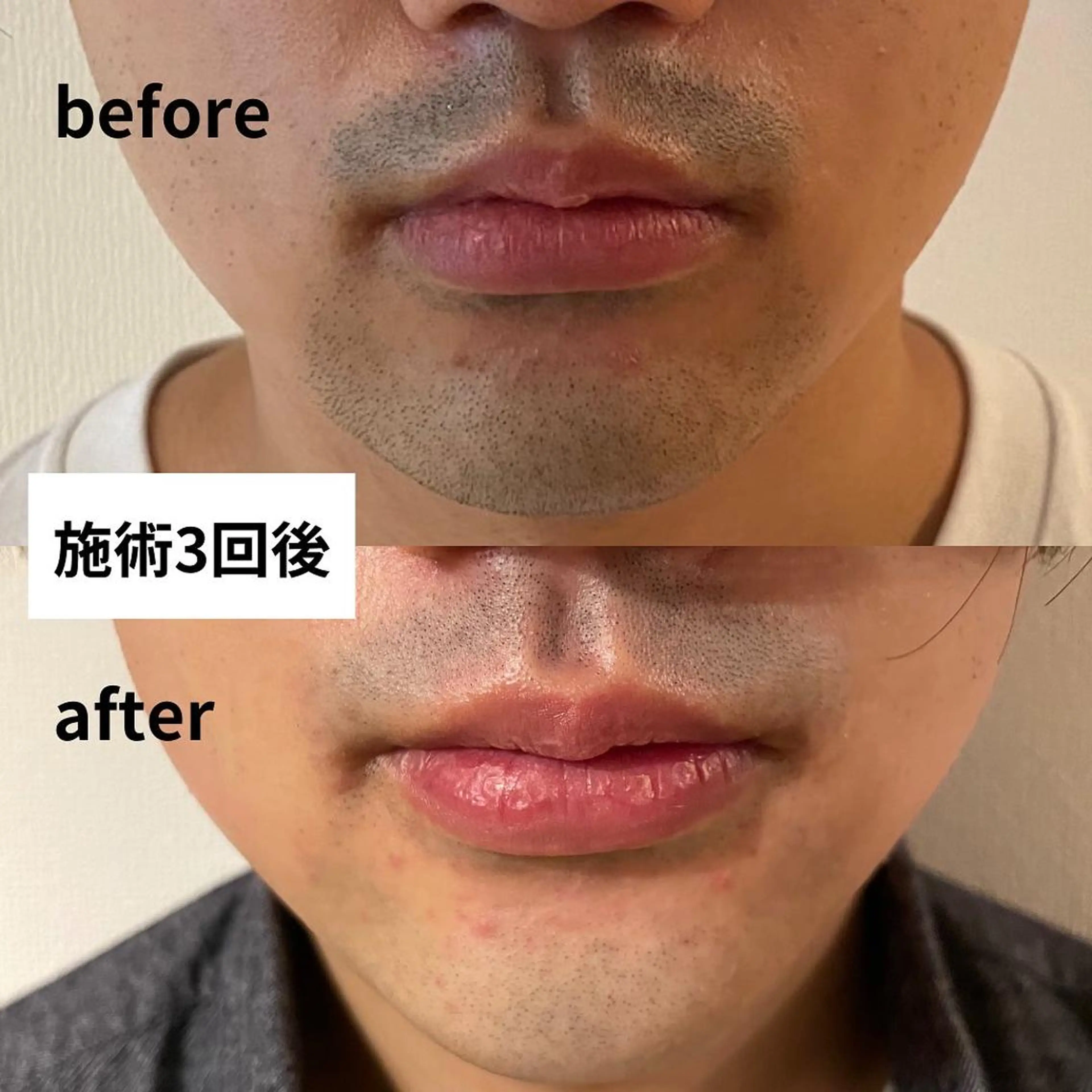 メンズ 盛岡メンズ脱毛CoCoサロン所属・メンズ脱毛サロン 上岡 翼のエステ・リラクイメージ