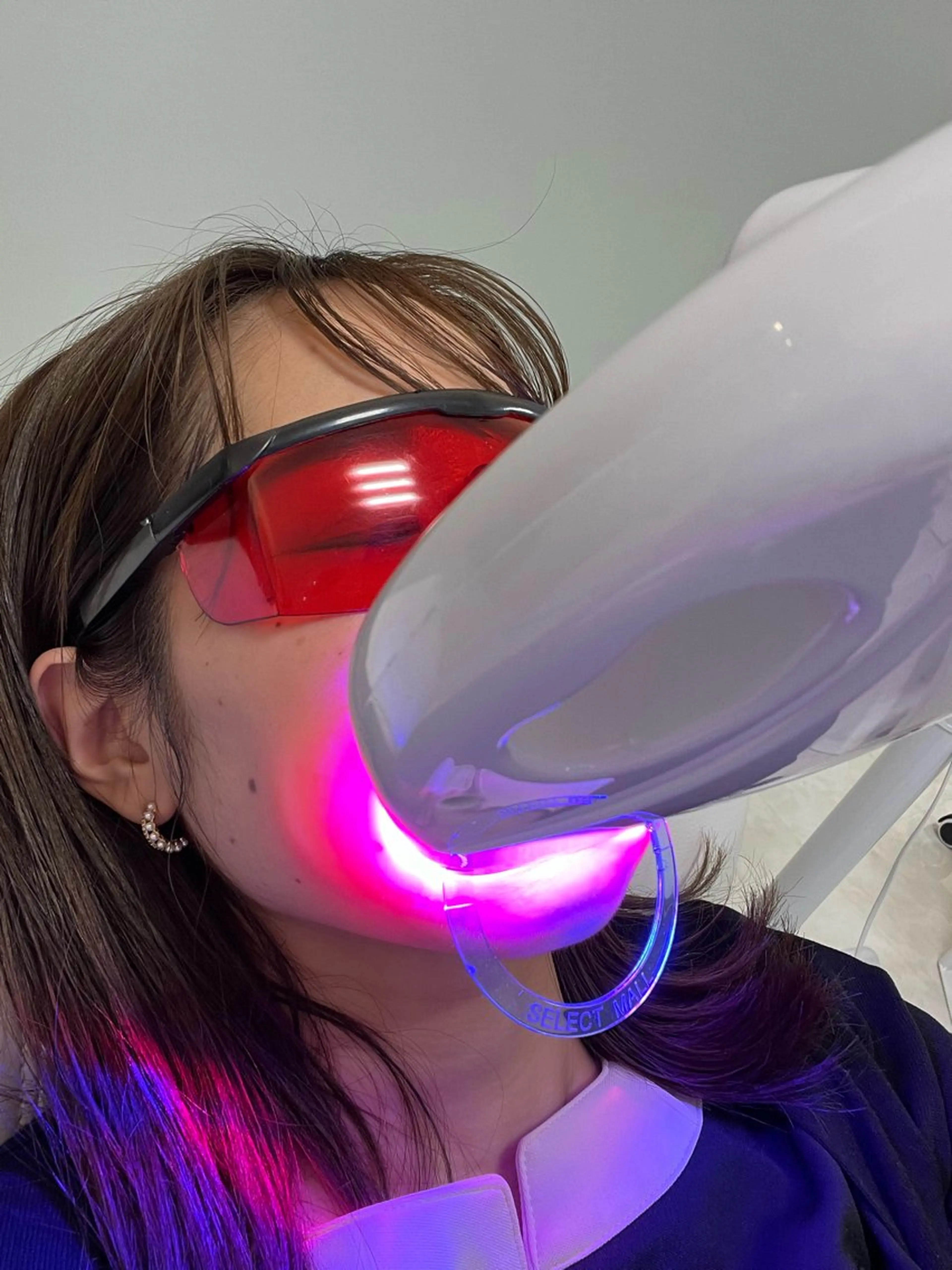 その他 エクシアホワイトニング草津店所属・nanami -ホワイトニングのその他イメージ