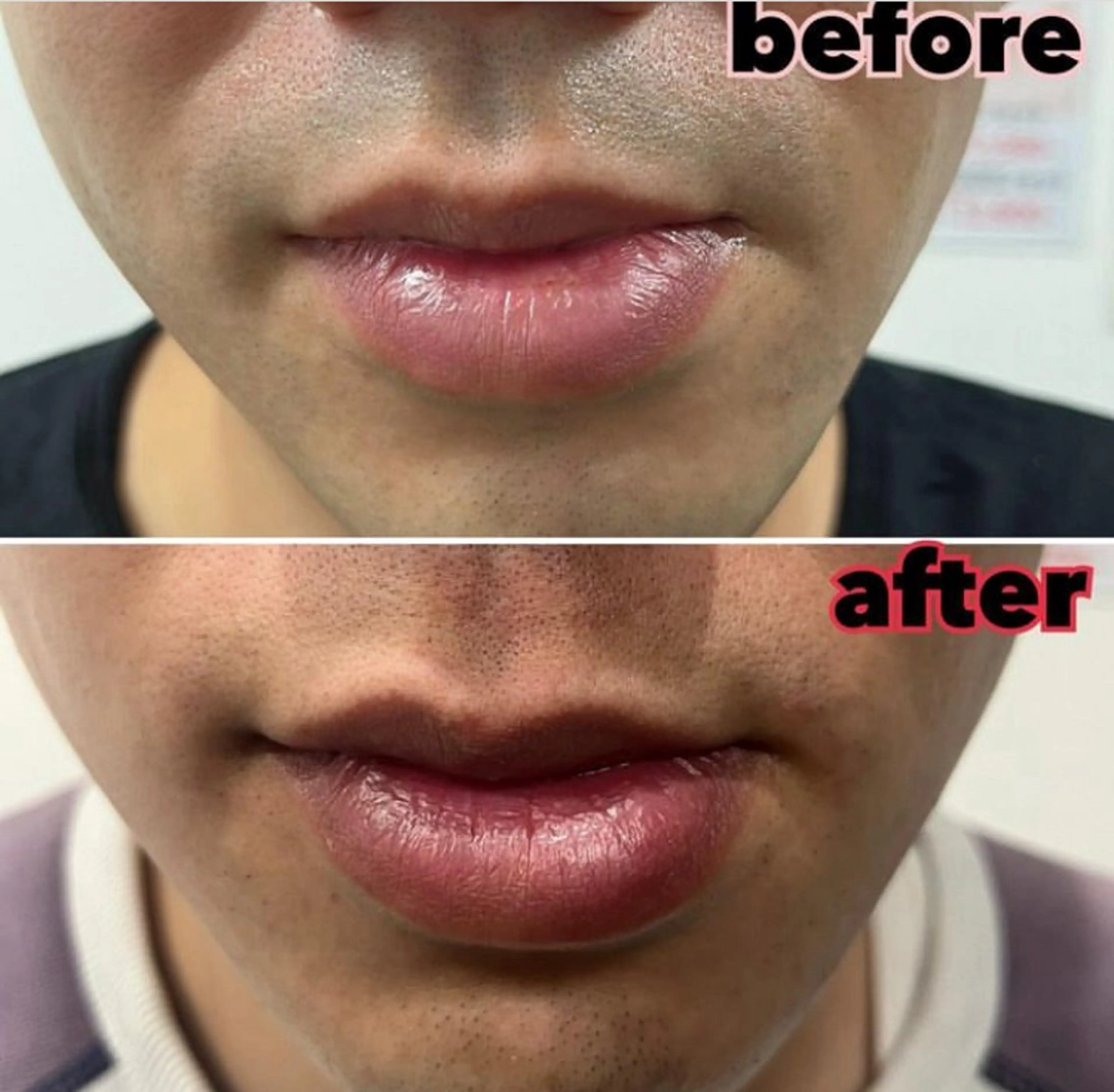 無人脱毛サロンMIRAE(ミレ)所属・無人セルフ脱毛サロン MIRAE(ミレ)のエステ・リラクイメージ