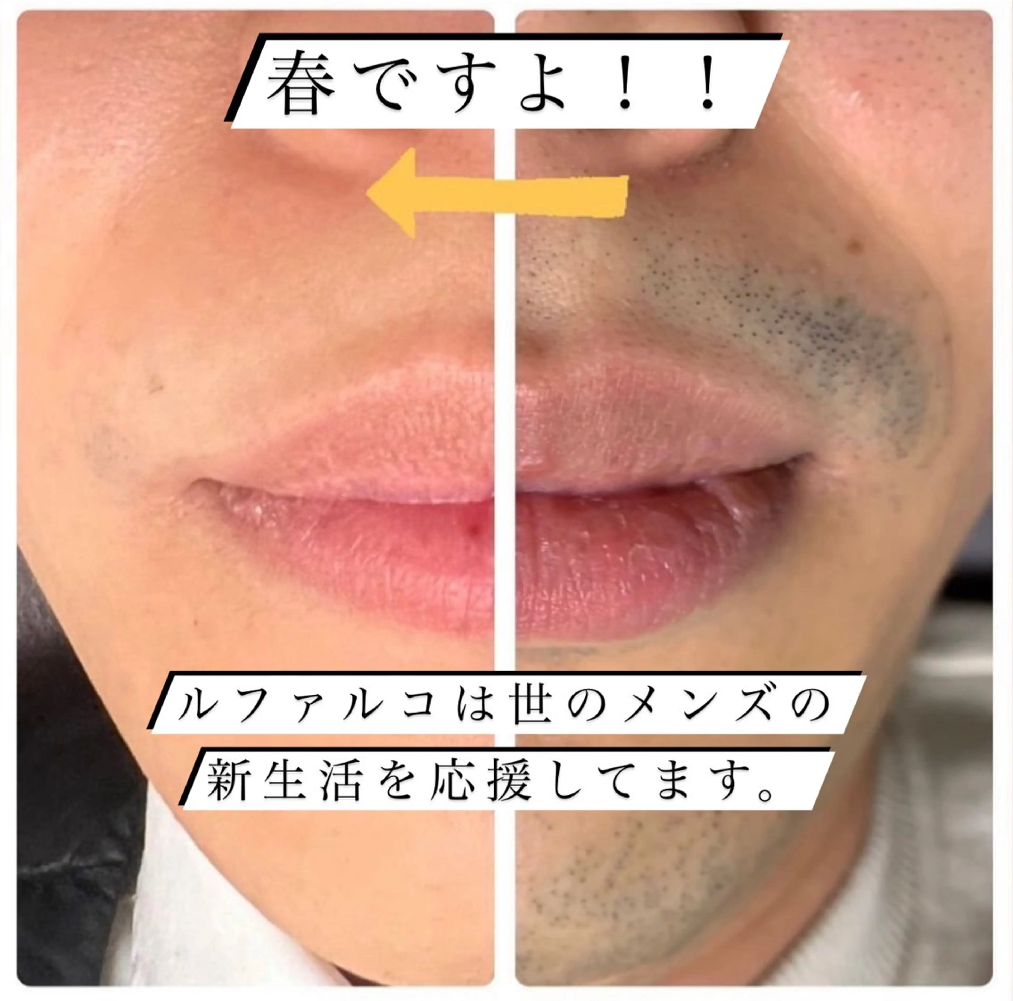 メンズ 脱毛 メンズ脱毛サロン Le falcoのエステ・リラクイメージ