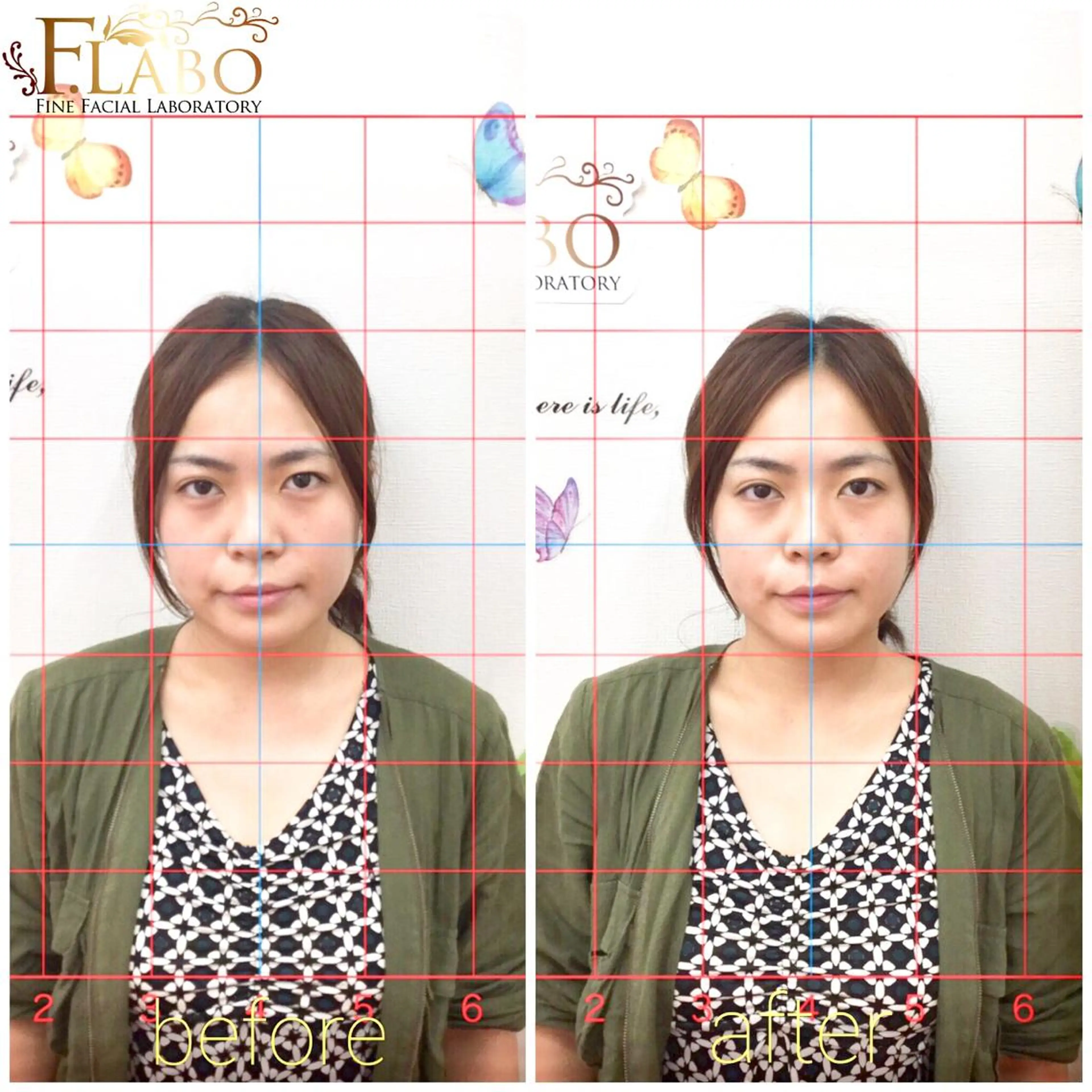 小顔&ダイエットジム エステ担当REIKOのその他イメージ