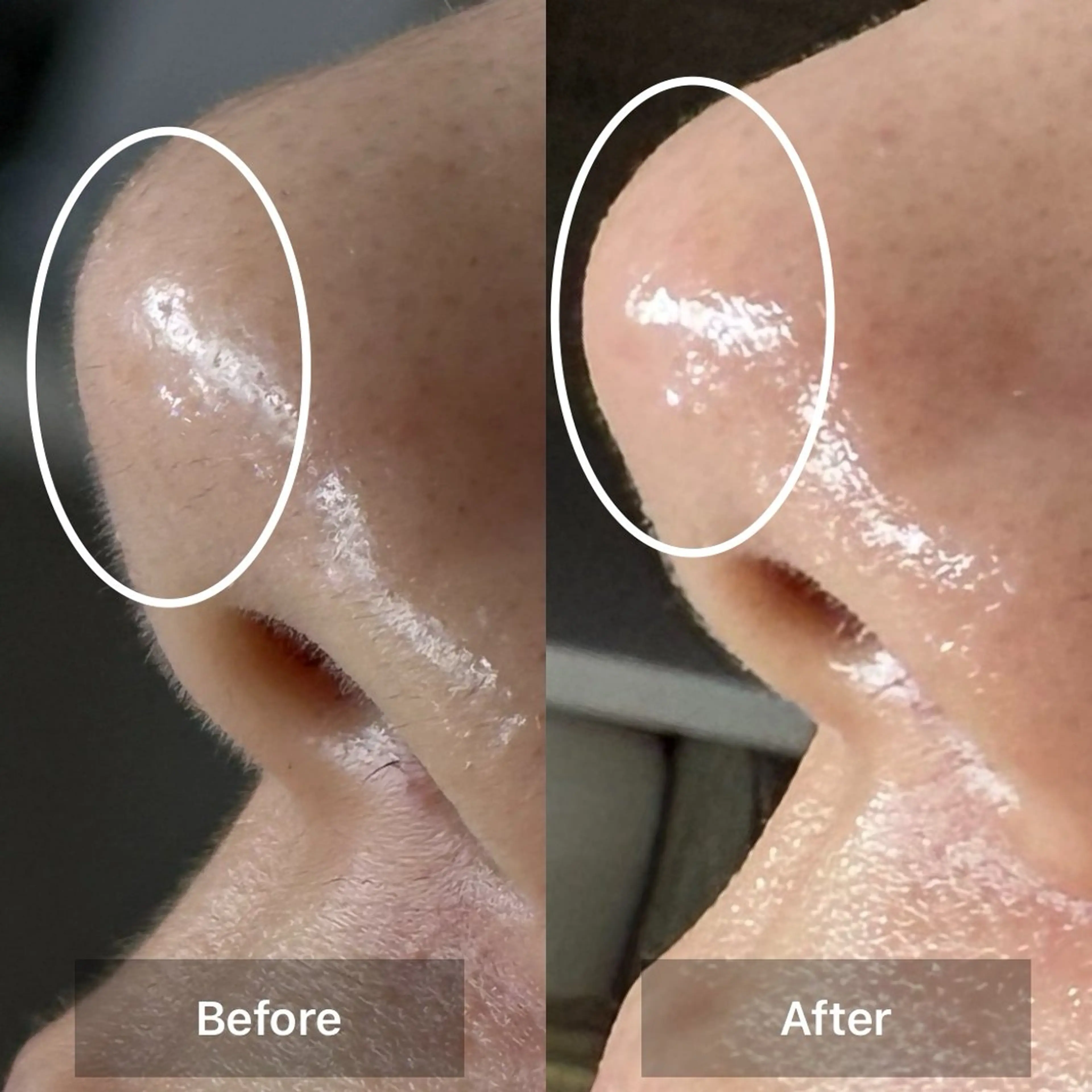 エステ Beauty salon LUNA所属・LUNA / Sakikoの眉毛・アイブロウイメージ