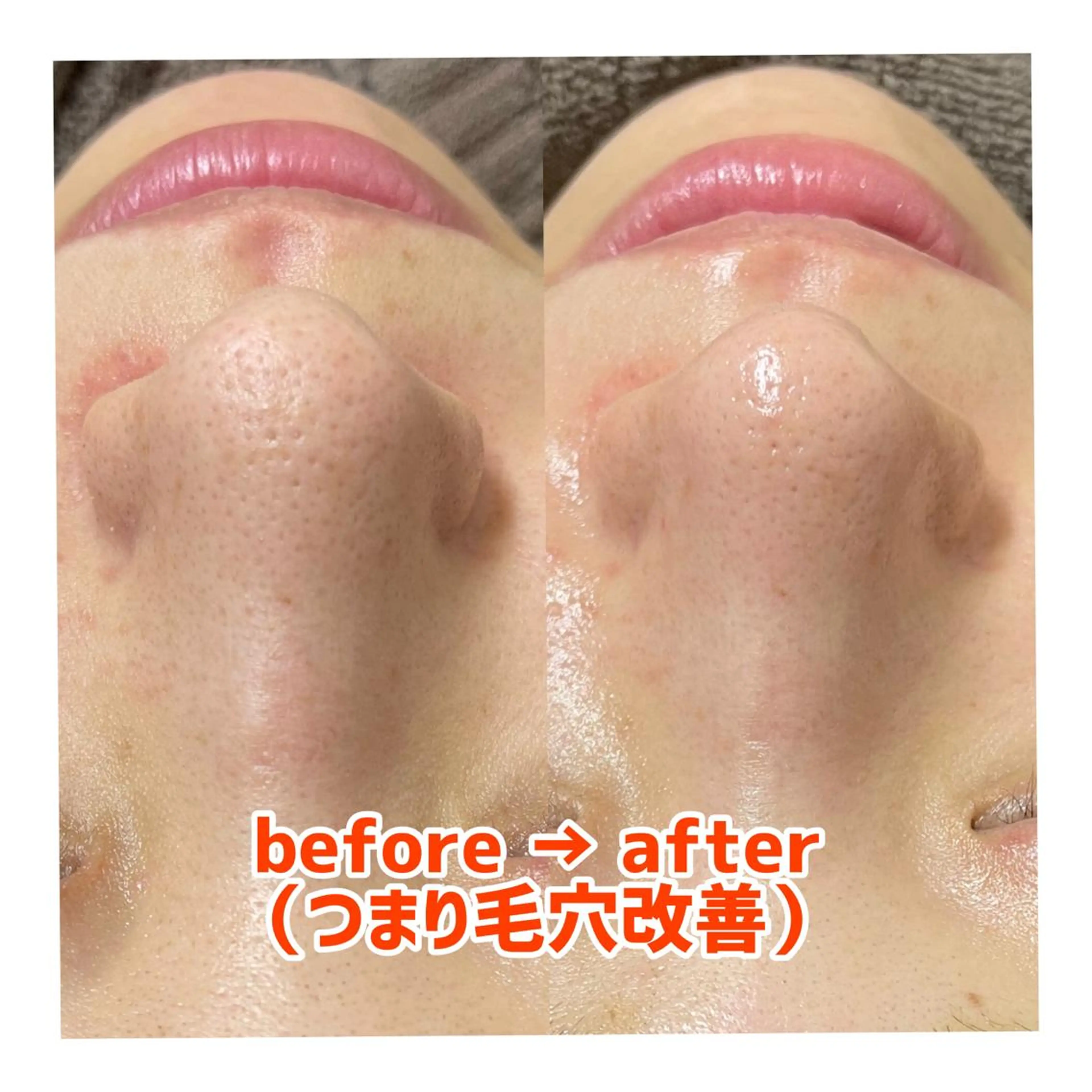 エステ 〜小顔・痩身・リラクゼーション〜　　Y&o Esthetic  Salon所属・HANA MIKIの眉毛・アイブロウイメージ