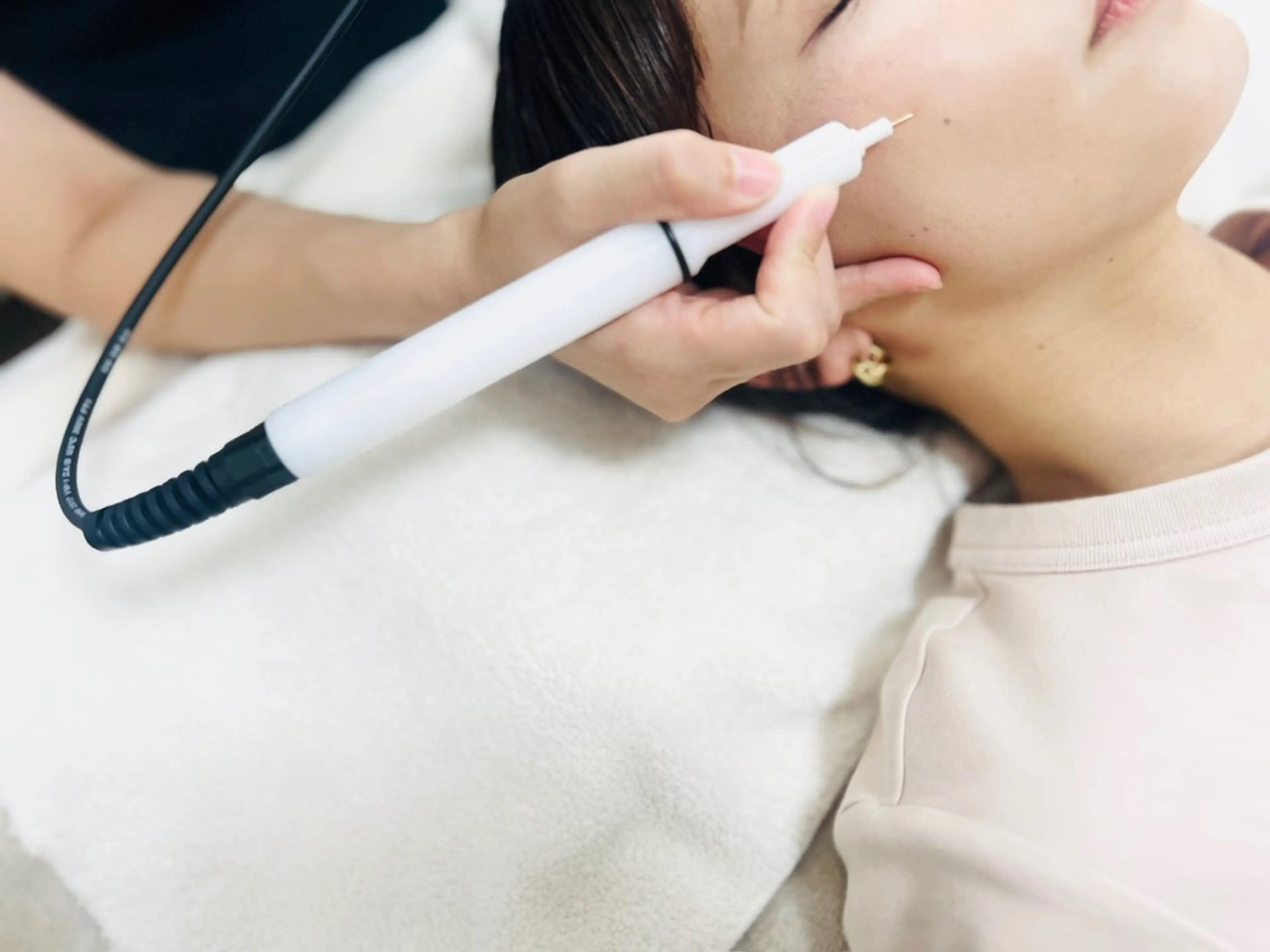 透明感ある素肌に⭐︎シミケア10分当て放題⭐︎美容液導入付の写真