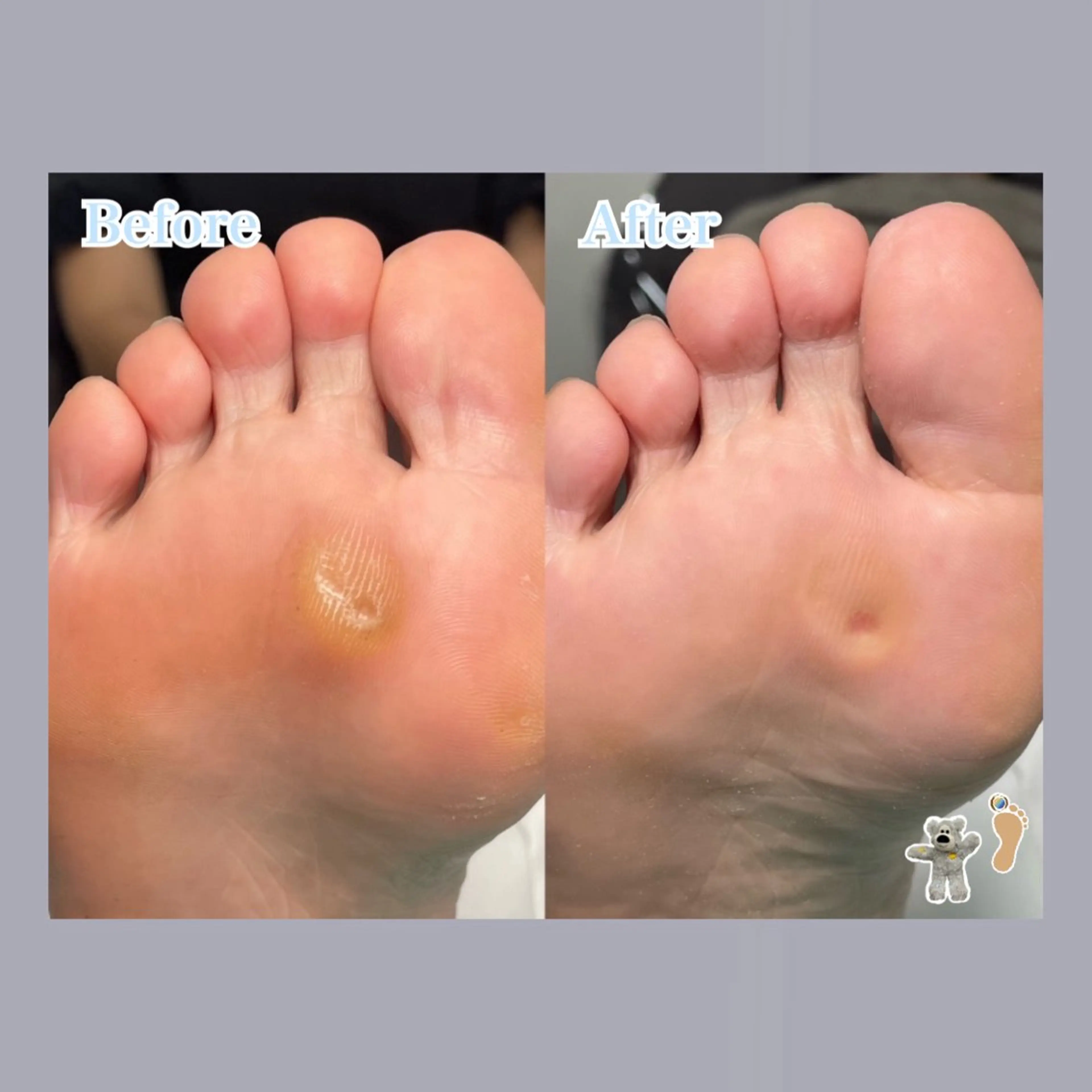 巻き爪補正店 大阪天王寺店のネイルデザイン