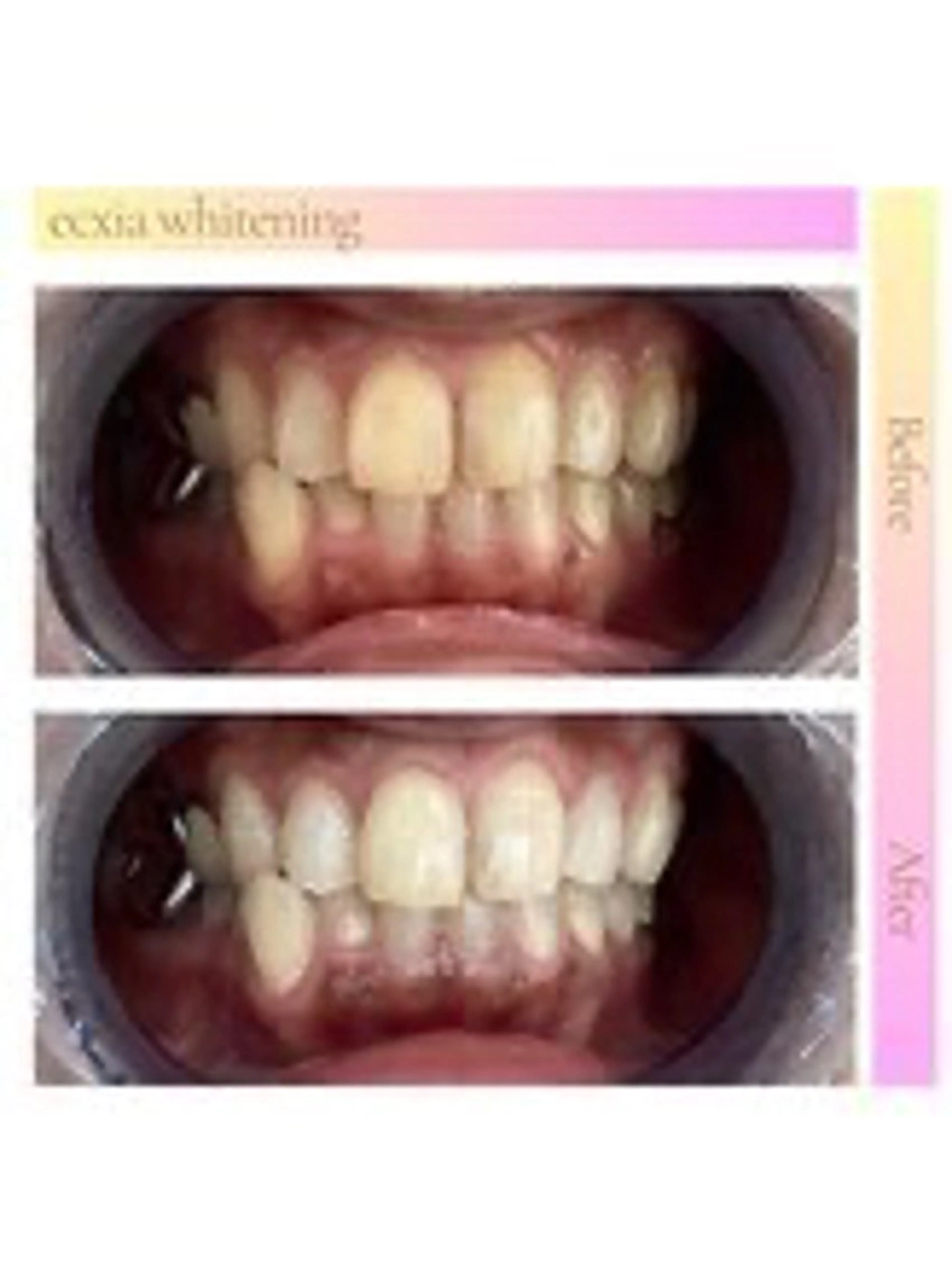 セルフホワイトニング エクシア西宮北口店所属・セルフホワイトニング エクシア西宮北口店のその他イメージ
