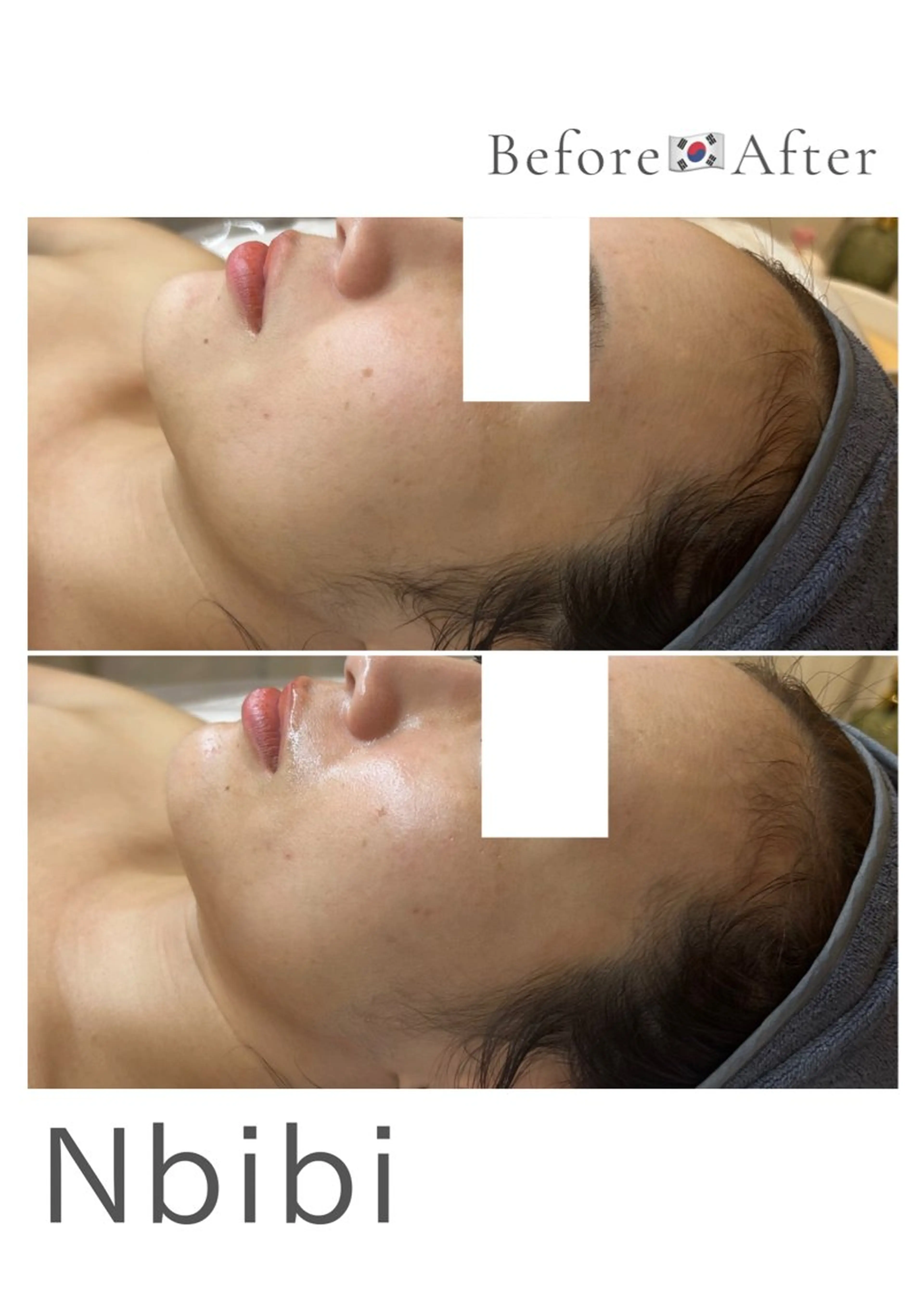 韓国🇰🇷価格 サロン_Nbibiのエステ・リラクイメージ