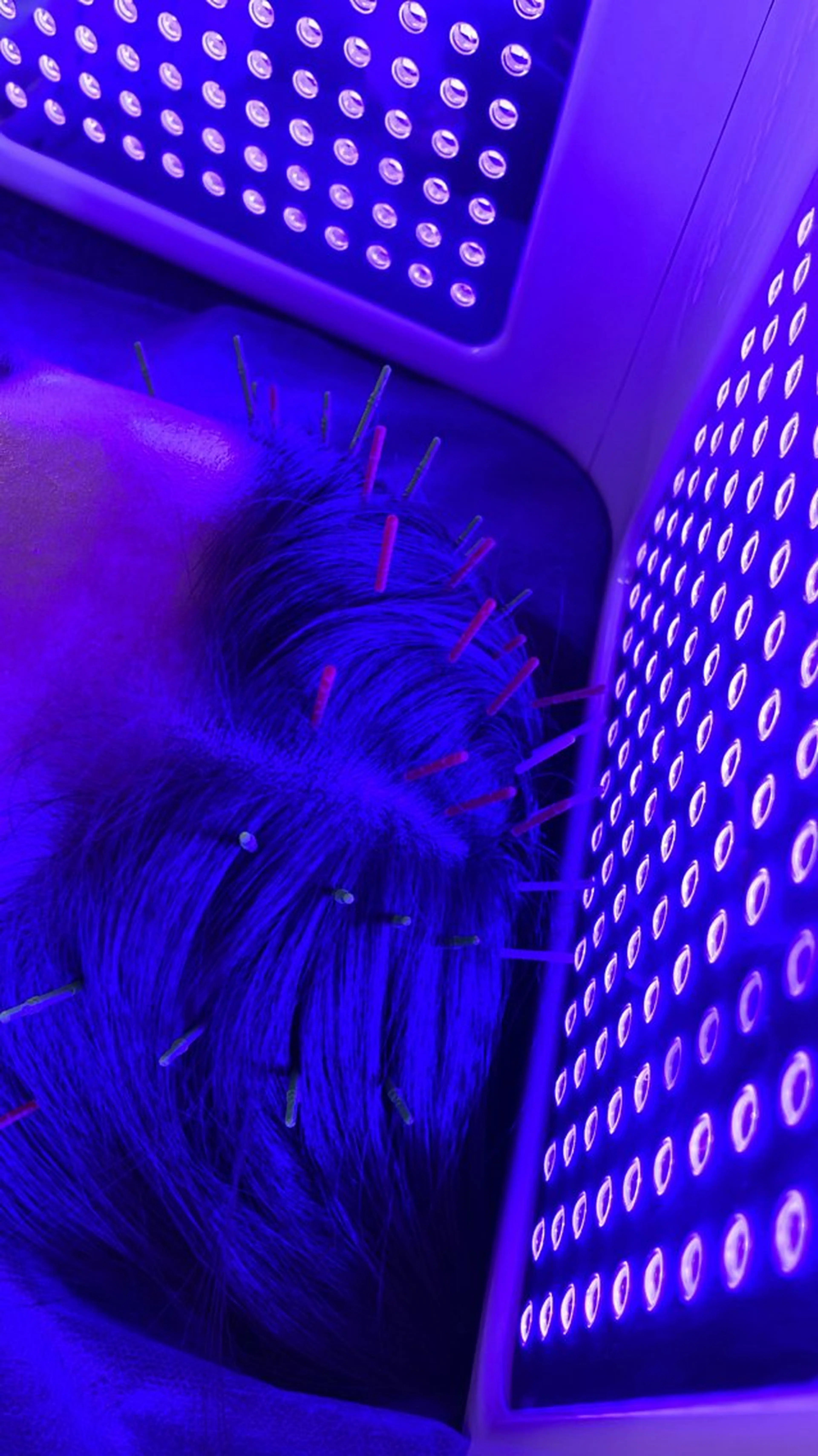 リラク 小顔美容鍼専門サロン 渋谷YZのエステ・リラクイメージ