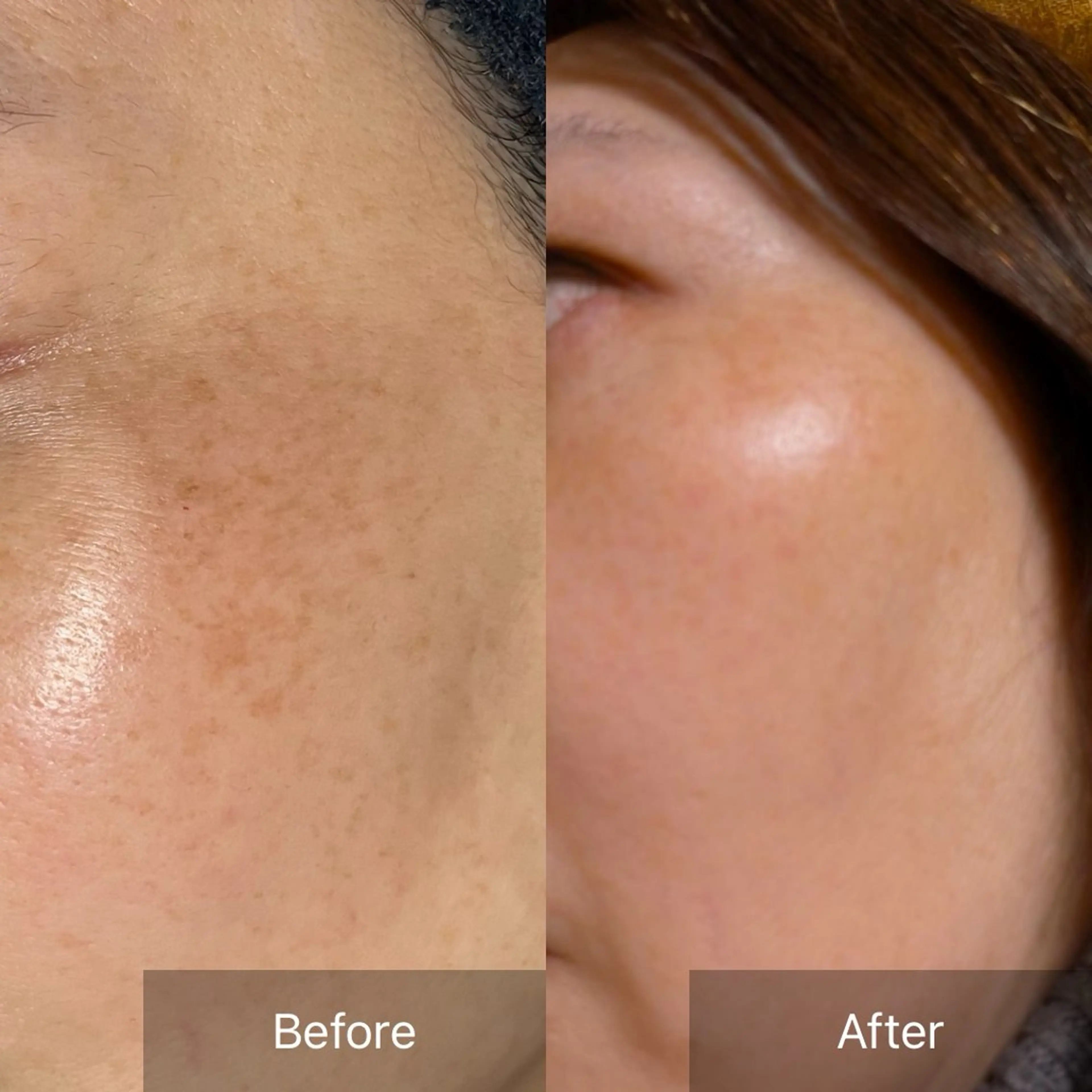 毛穴が見えなくなるサロン  Horo所属・岡 えり子のエステ・リラクイメージ