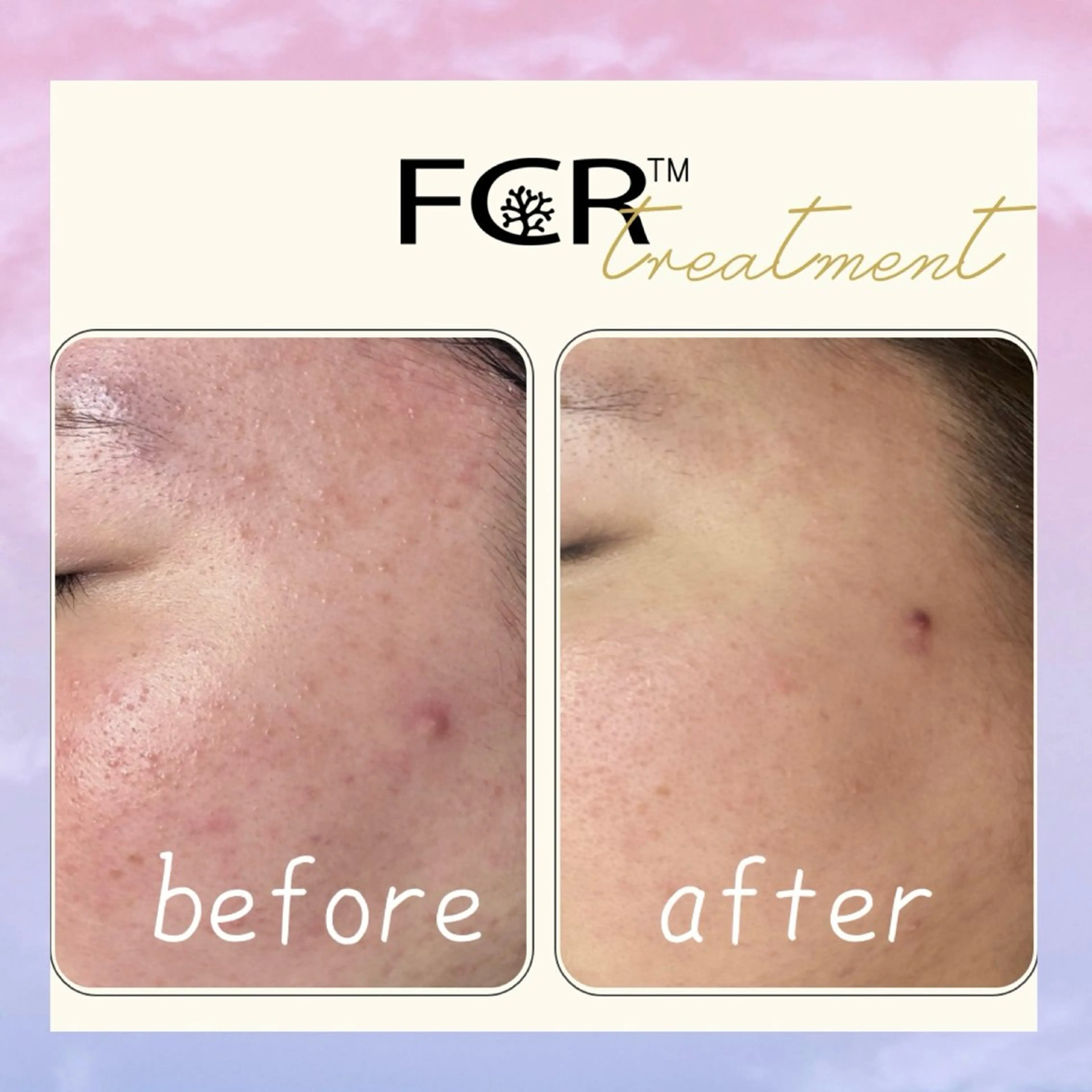 肌質改善Charme coco  増毛のエステ・リラクイメージ