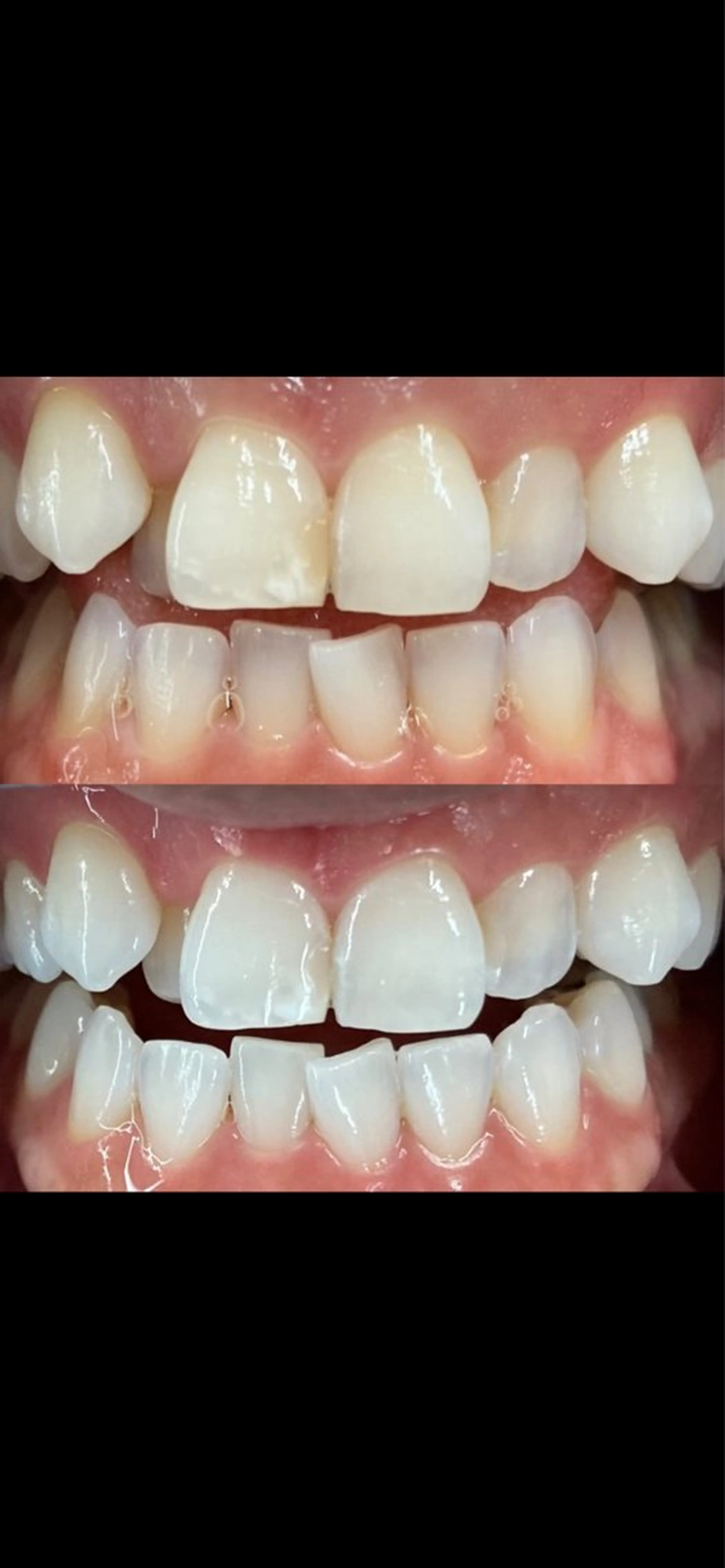 io teeth careのその他イメージ