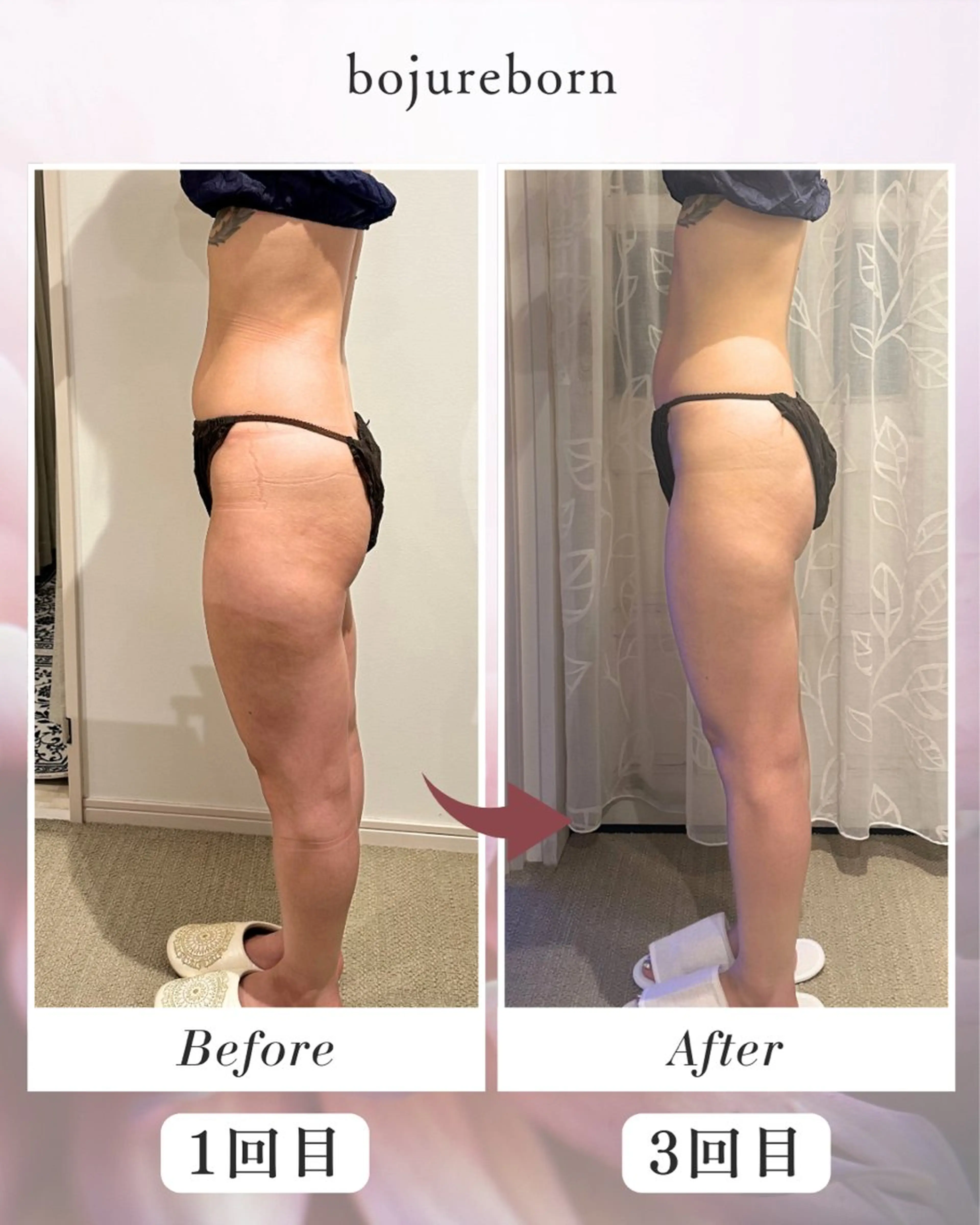 boju reborn所属・KUNIMASA MISATOのエステ・リラクイメージ