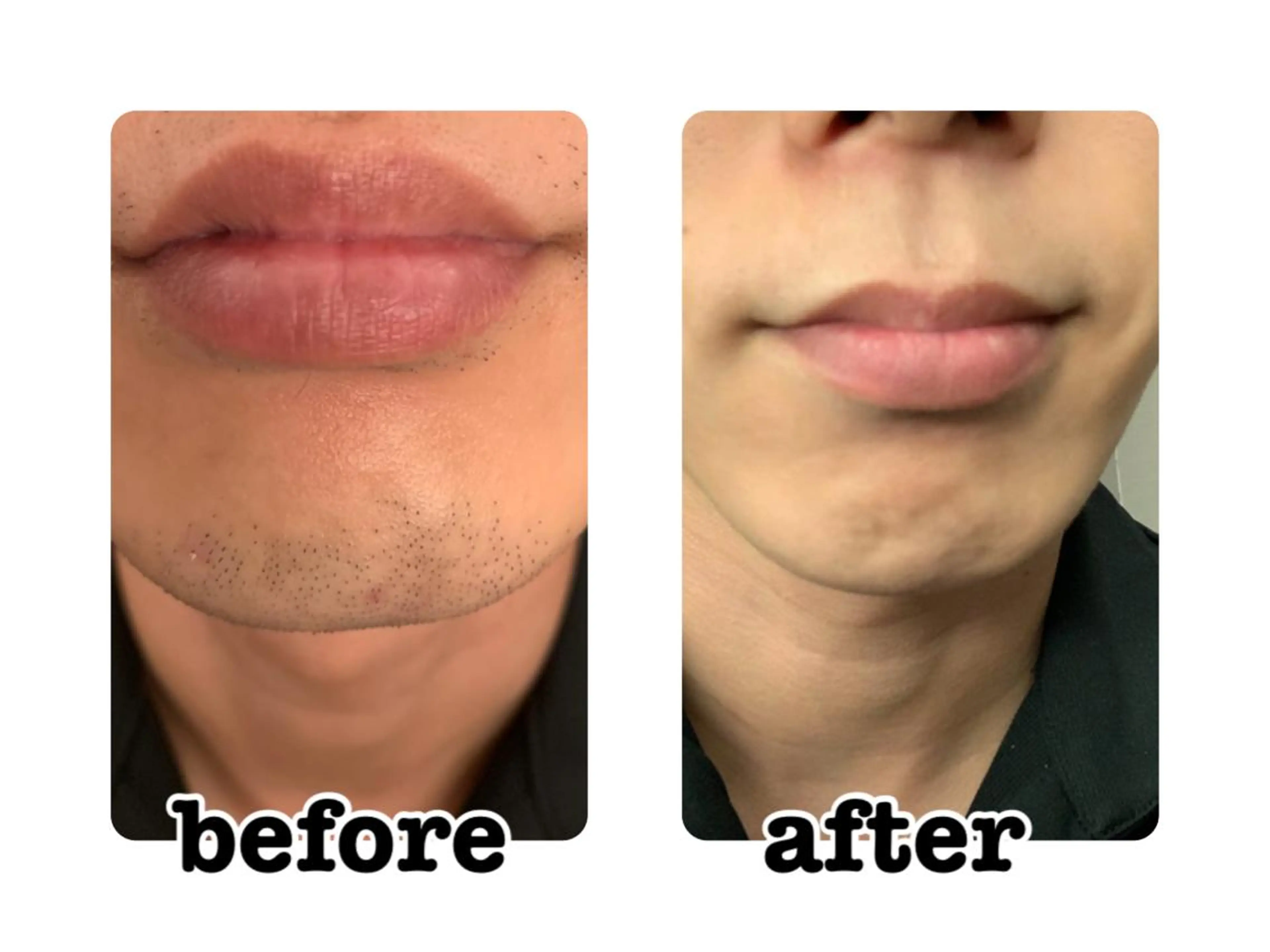 メンズ 男女同額完全個室脱毛 LEPIA内田のエステ・リラクイメージ