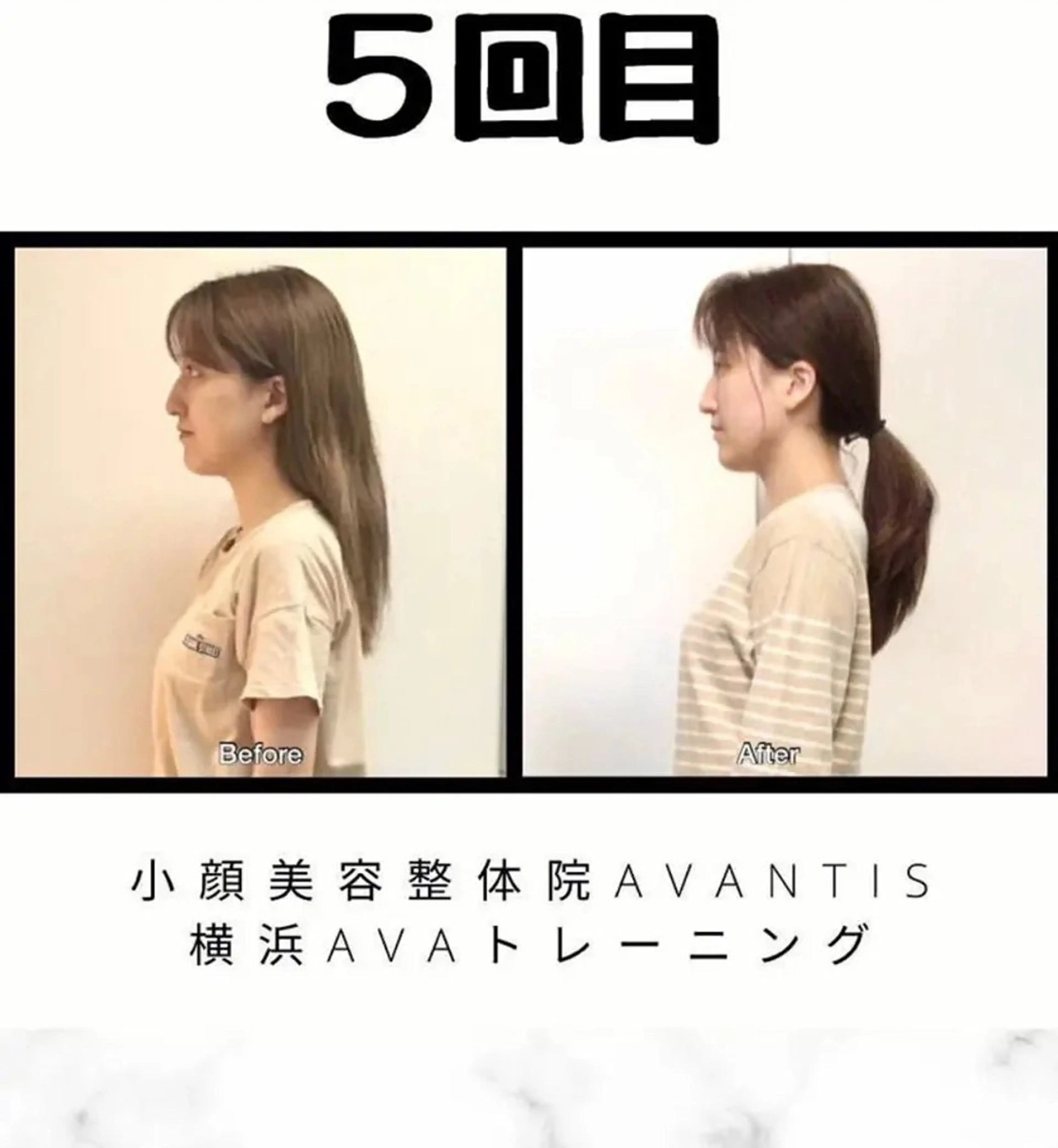 【当院人気NO.2クーポン！！】頭蓋骨・小顔矯正+骨盤矯正￥12,000円→4500円！！の写真